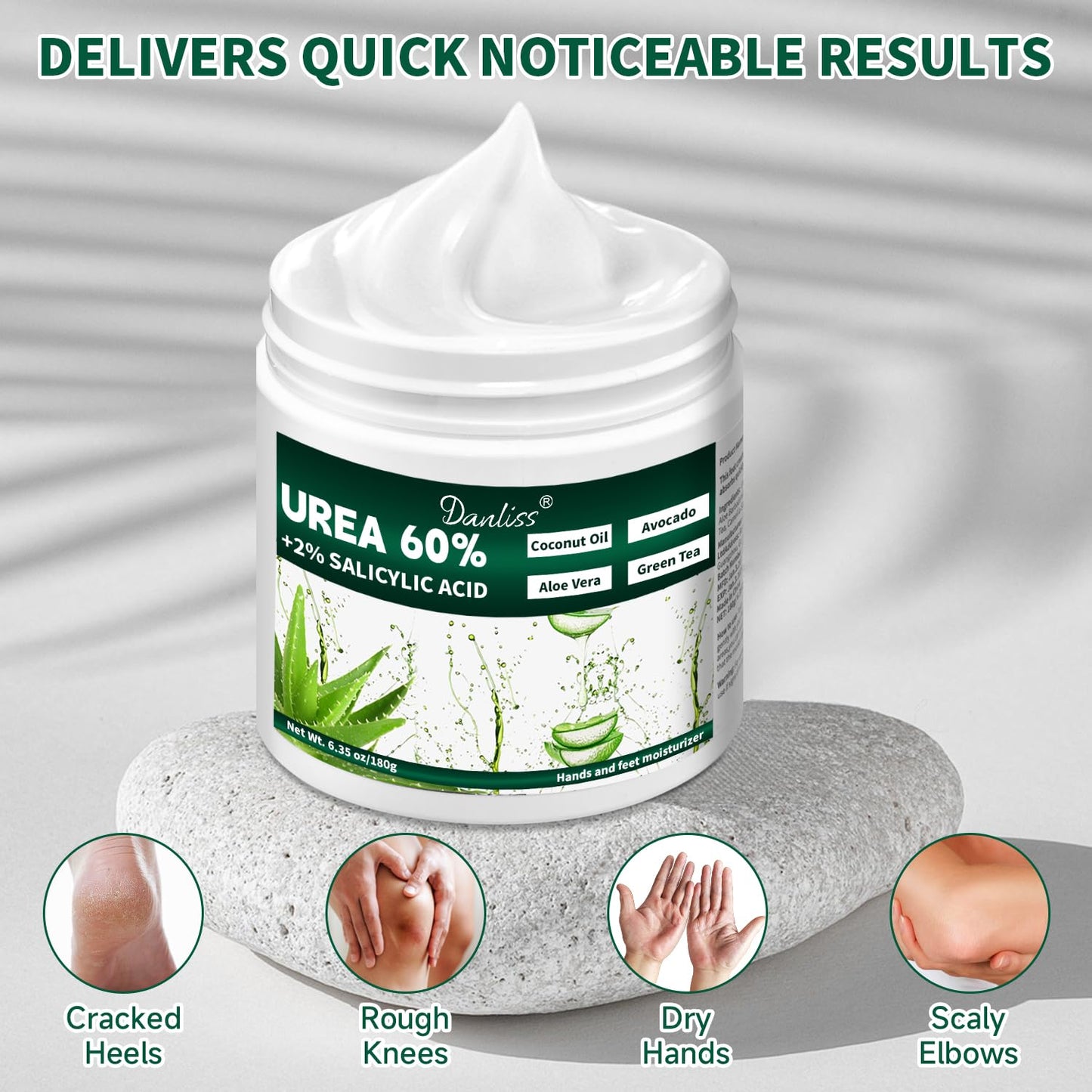 Danliss Urea Cream 60% with 2% Salicylic Acid – Unscented 60 Percent Urea Maximum Strength for Dry, Cracked Heels, Hands, Knees, and Elbows. Dead Skin Remover & Callus Repair Treatment 6.35 oz