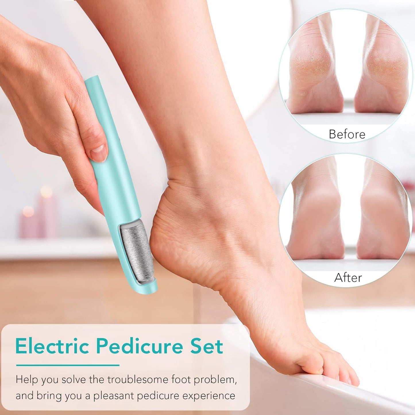 Electric Callus Remover - Professional Foot Scrubber Kit for Dry, Cracked Skin | At-Home Pedicure Spa Care (Blue)