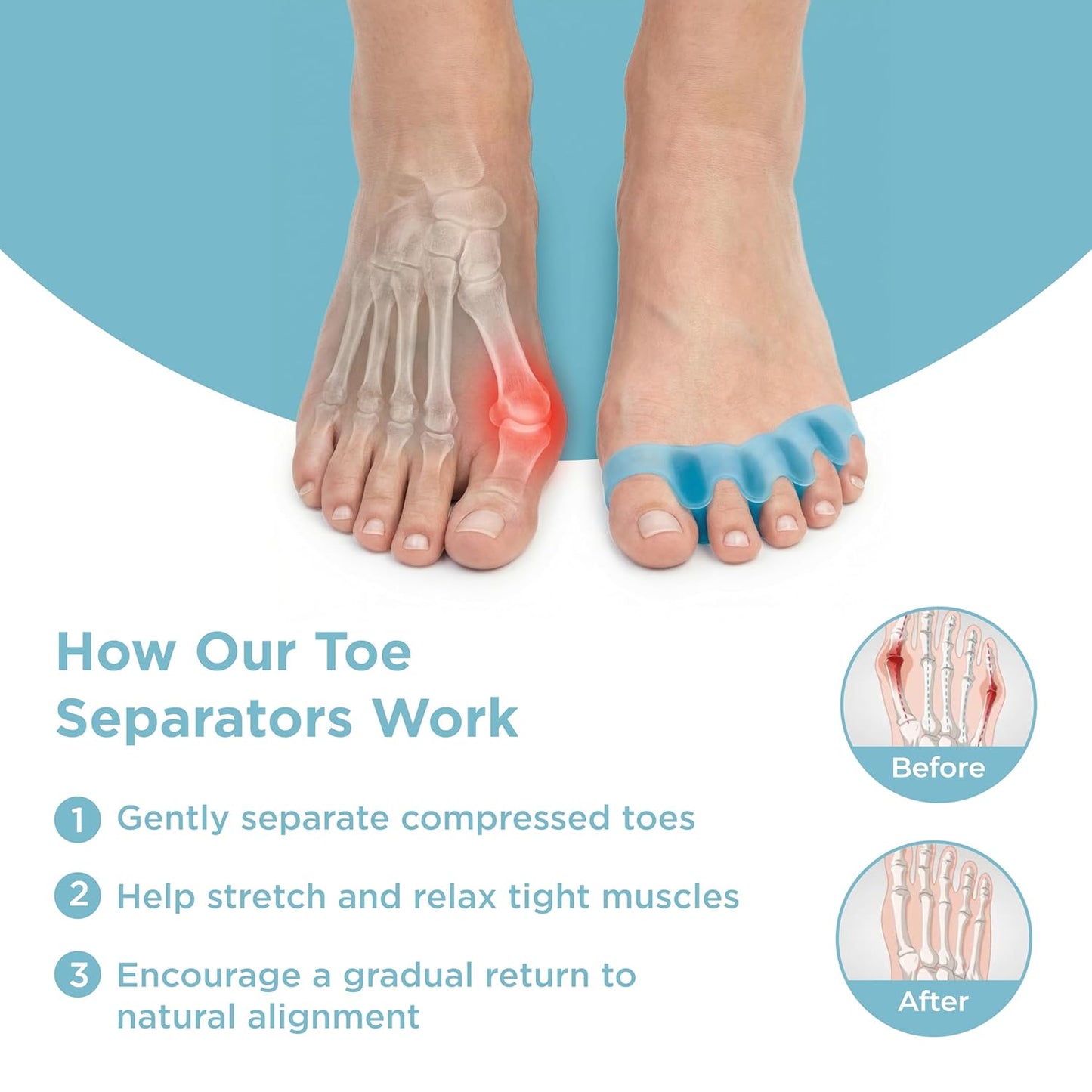 Toe Separators for Men and Women - Comfortable Blue Toe Spacers for Alignment | Regular Size