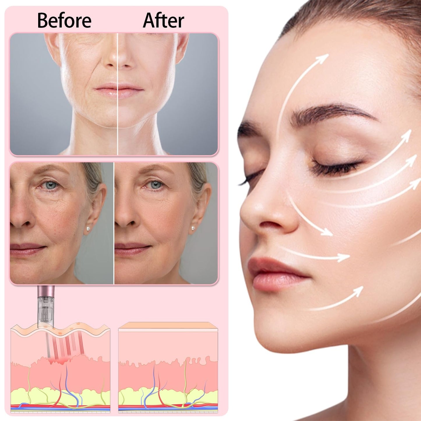 Microneedle Derma Roller - 0.25mm Microneedling Pen for Effective Skin Care | Home Use for Men & Women