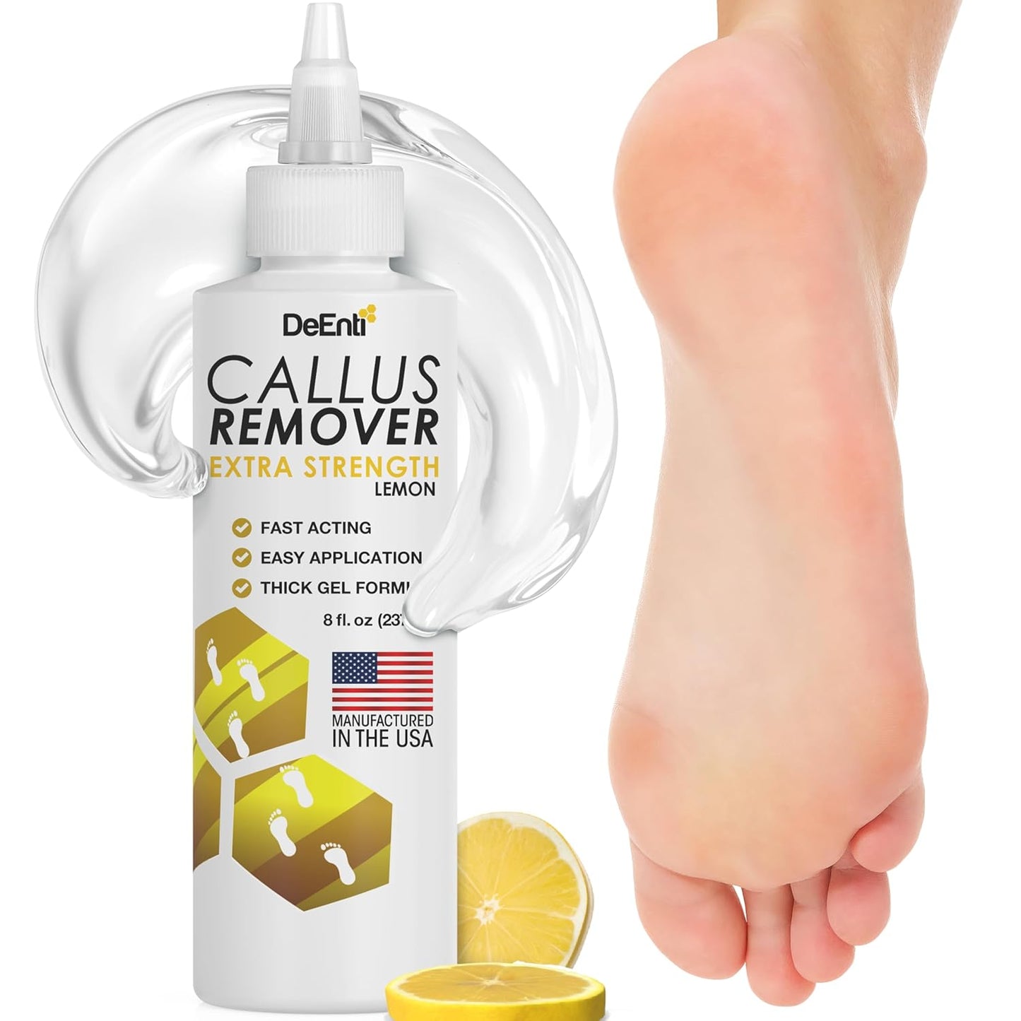 Callus Remover Gel for Feet - Extra Strength 8oz | Professional Pedicure Supplies for Dry Skin & Cracked Heels