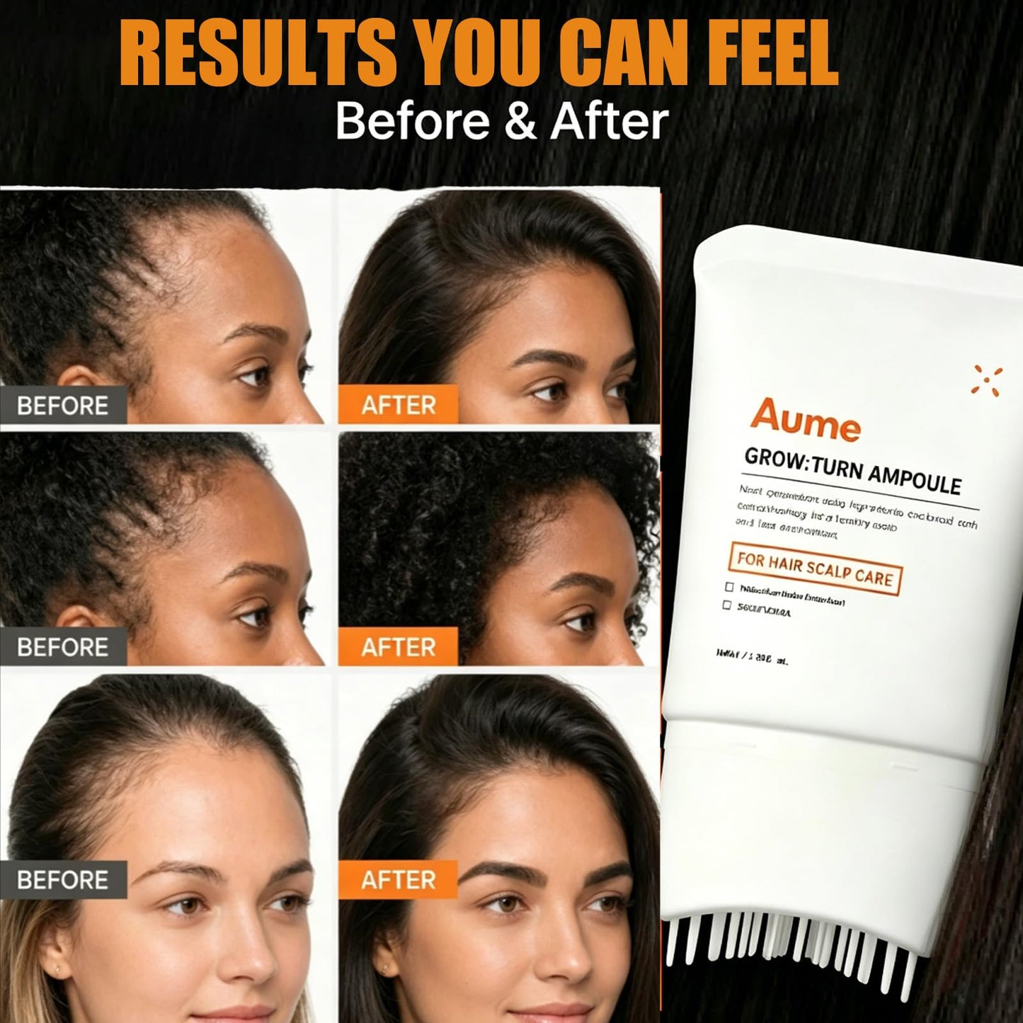 Aume Hair Growth,Hair Serum，Gentle Scalp Care,3.38 fl. oz