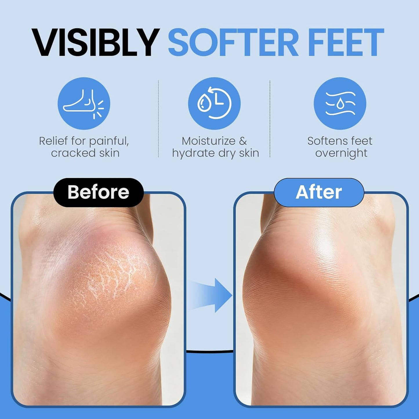Silicone Moisturizing Socks for Dry Cracked Feet - Aloe Spa Hydrating Foot Care | Large (Up to Size 12)
