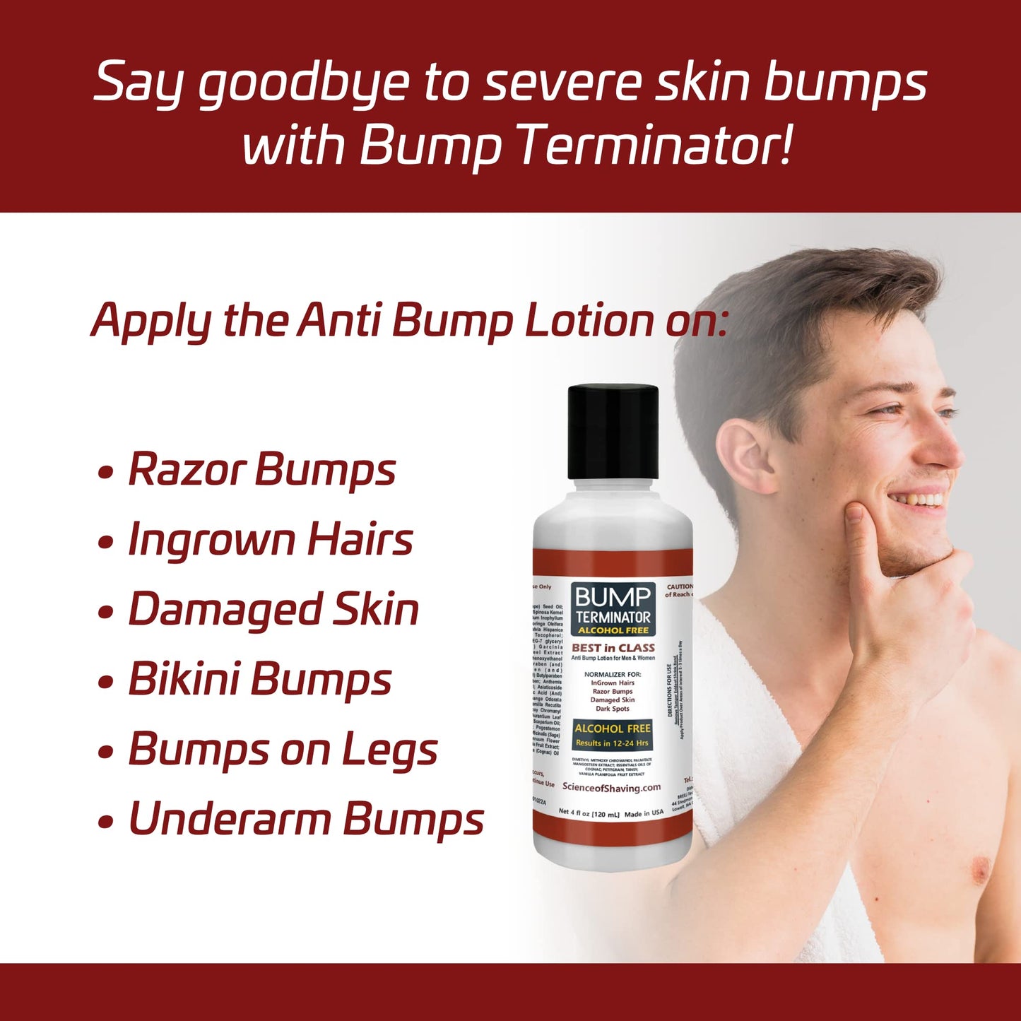 BREEJ Bump Terminator Alcohol-Free Bumps Lotion, Razor Bump Treatment for Men & Women (4 Fluid Ounces)