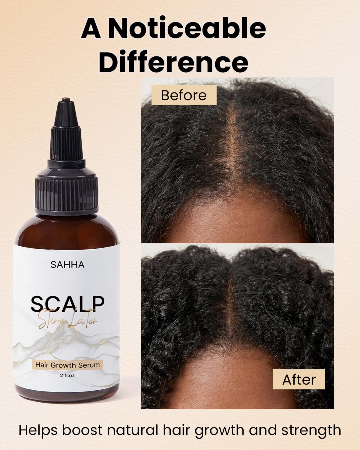 Hair Growth Oil - Scalp Stimulator with Cold Pressed Rosemary Mint & Grapeseed Oil | 2 Fl Oz, All Hair Types