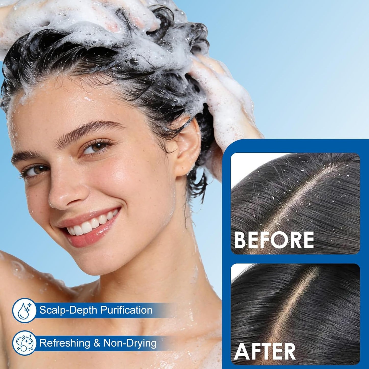 Dandruff Control Shampoo - Sulfate & Paraben-Free Daily Cleanser for Dry Itchy Scalp | 10.14 FL OZ