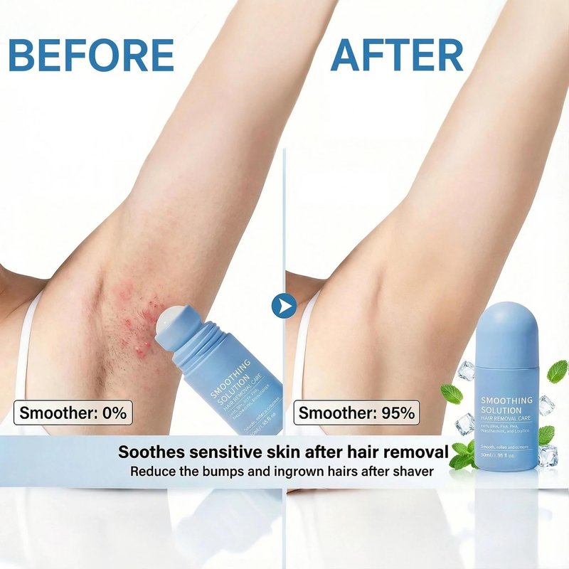 Ingrown Hair Treatment Serum – Smoothing Solution for Razor Bumps & Hair Removal Aftercare | Hydrating Care for Underarms, Legs, Bikini Line & Arms