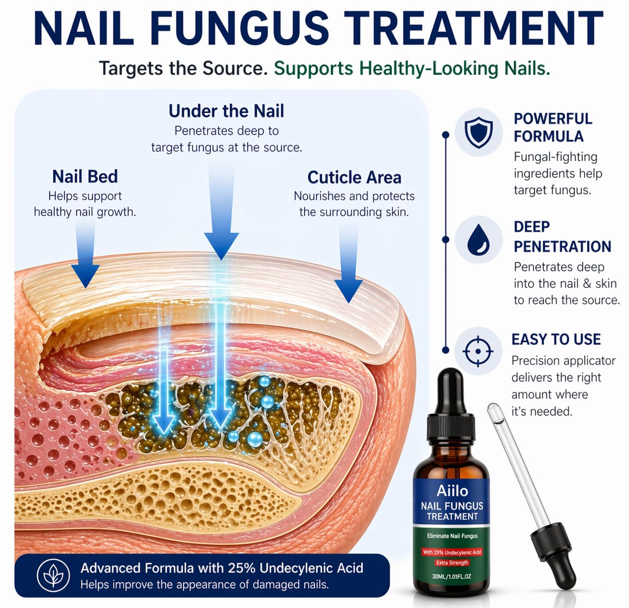 Nail Fungus Treatment - 25% Undecylenic Acid Liquid for Toenails & Fingernails | Extra Strength Nail Repair Solution, 2.02 Fl Oz