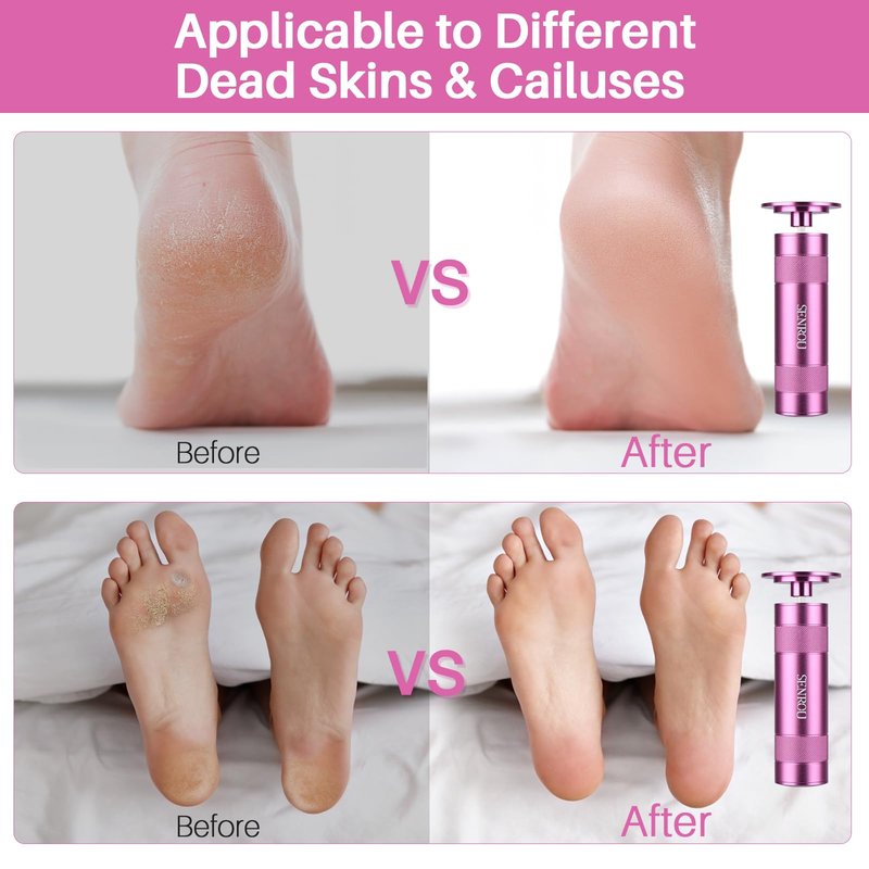Electric Foot File Callus Remover, 2-in-1 Pedicure Tool with 60 Sandpaper Discs, Adjustable Speed