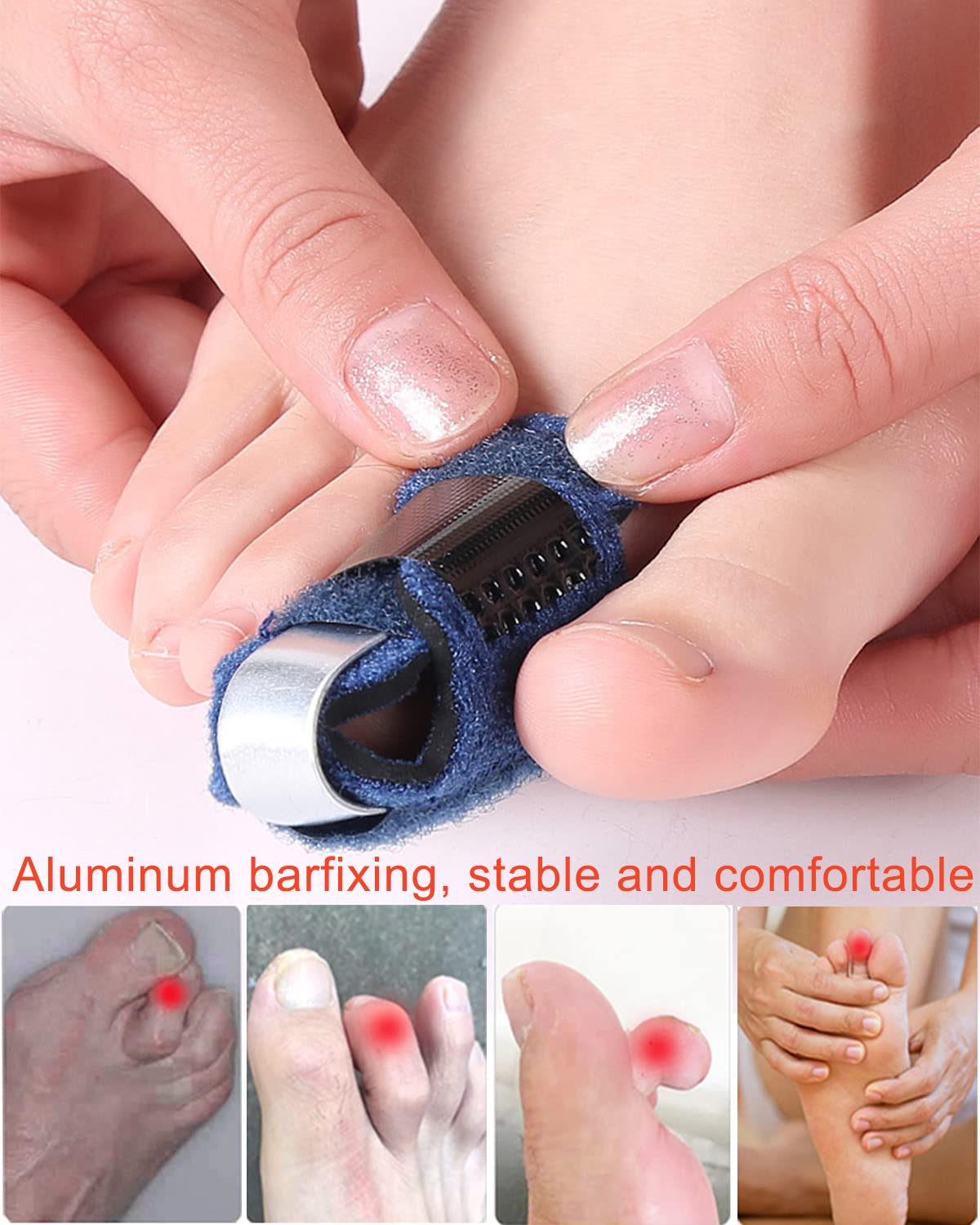 Golbylicc 1 Pair Toe Splint Broken Toe Brace Toe Straightener for Hammer Toe, Curled Toe, Big Toe, Women Men Broken Toe Support Toe Wraps
