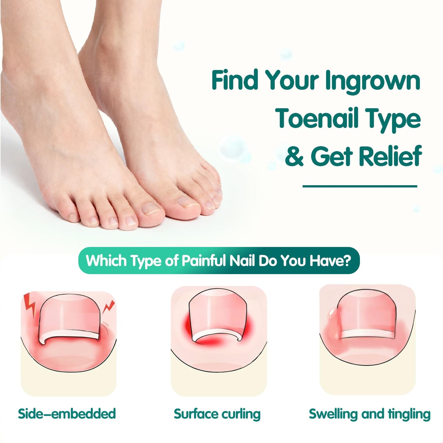 60 Pcs Breathable Ingrown Toenail Strips, Toenail Corrector Patch for Ingrown Toenail Relief, Painless Toenail Support Tool