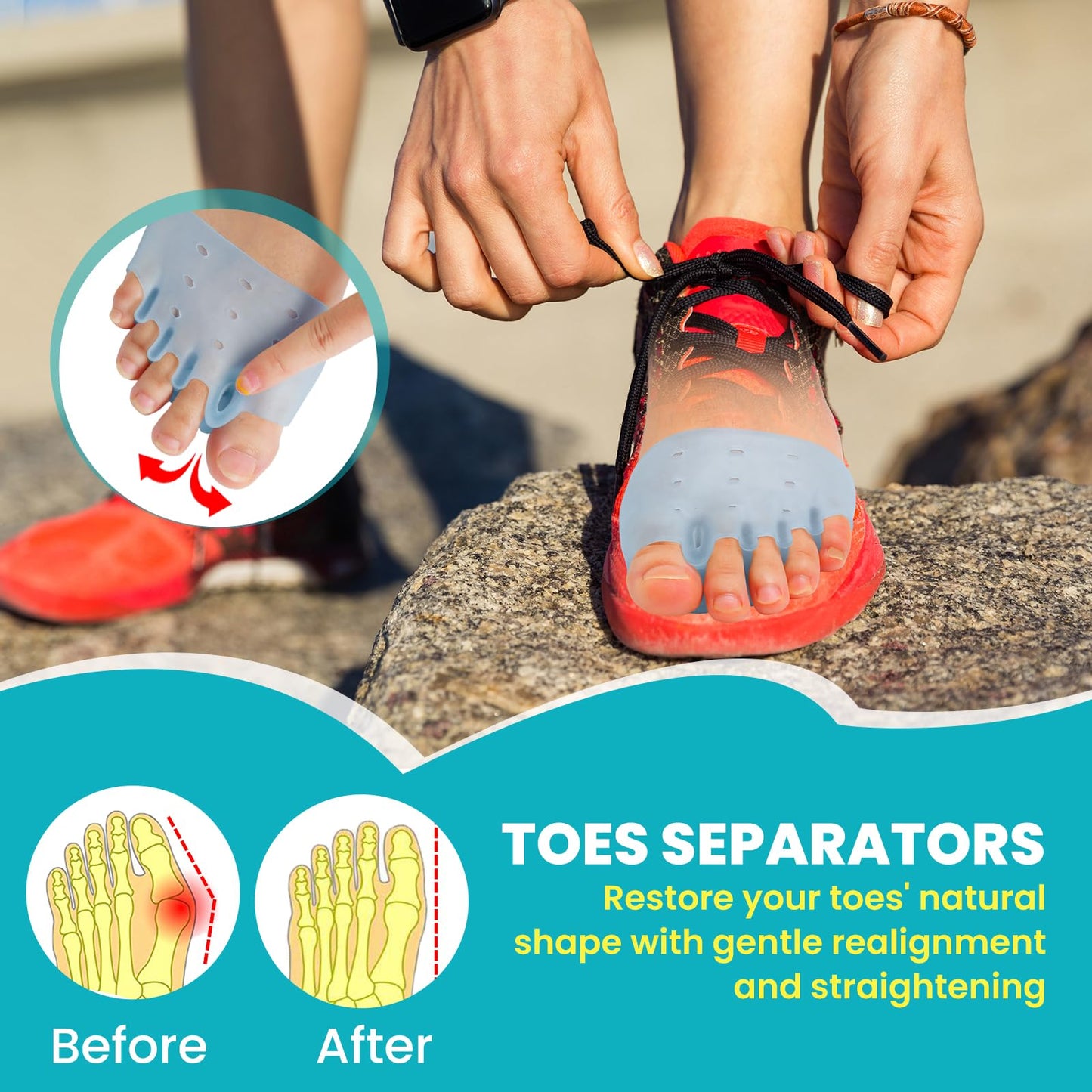 TASZOOS Toe Separators & Metatarsal Pads for Women & Men – 4 Pcs Gel Toe Spacers, Ball of Foot Cushions for Pain Relief, Metatarsalgia, Morton’s Neuroma, Comfortable Foot Pads for Walking(One Size)