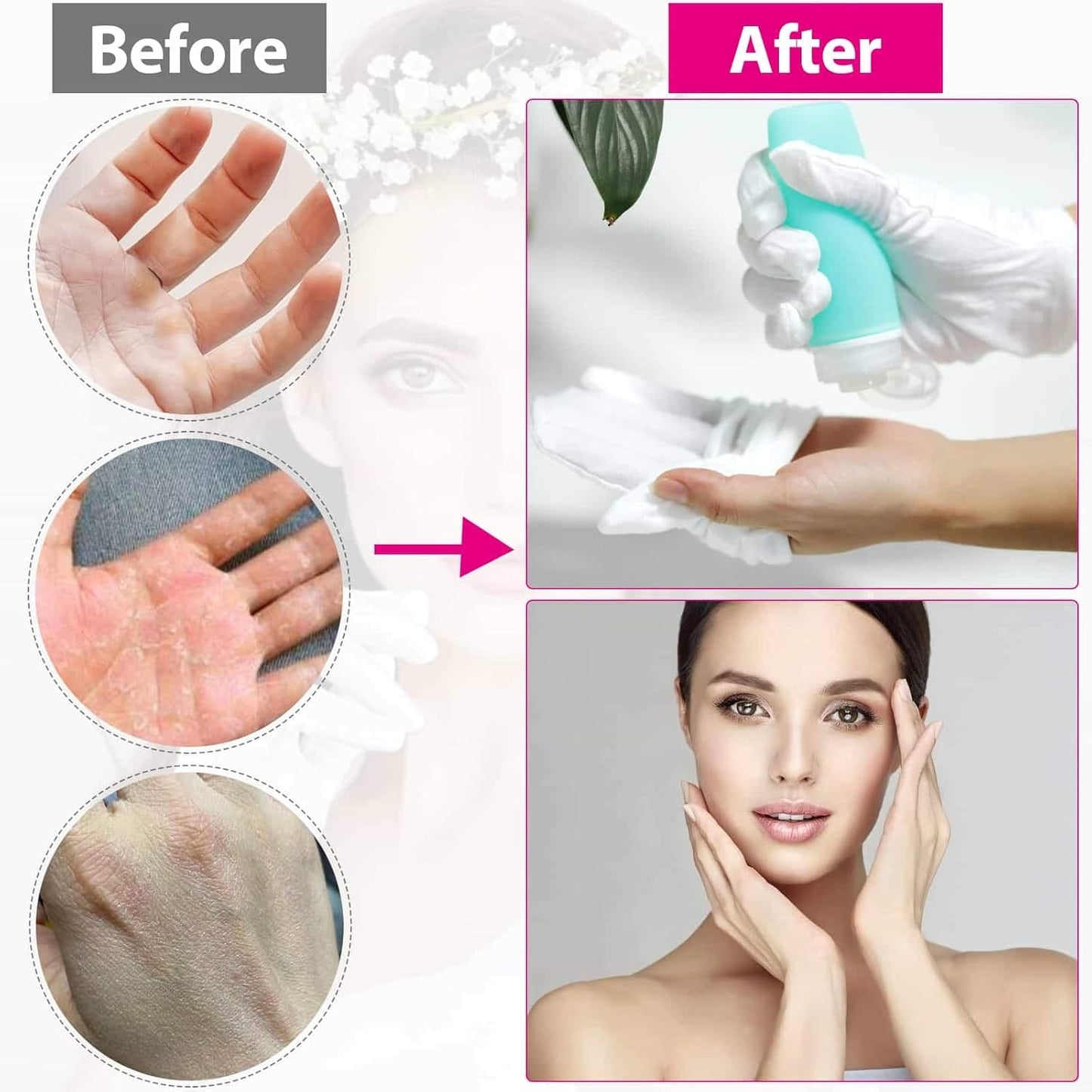 Cotton Gloves for Dry Hands - Moisturizing Eczema Relief | Medium Size, White