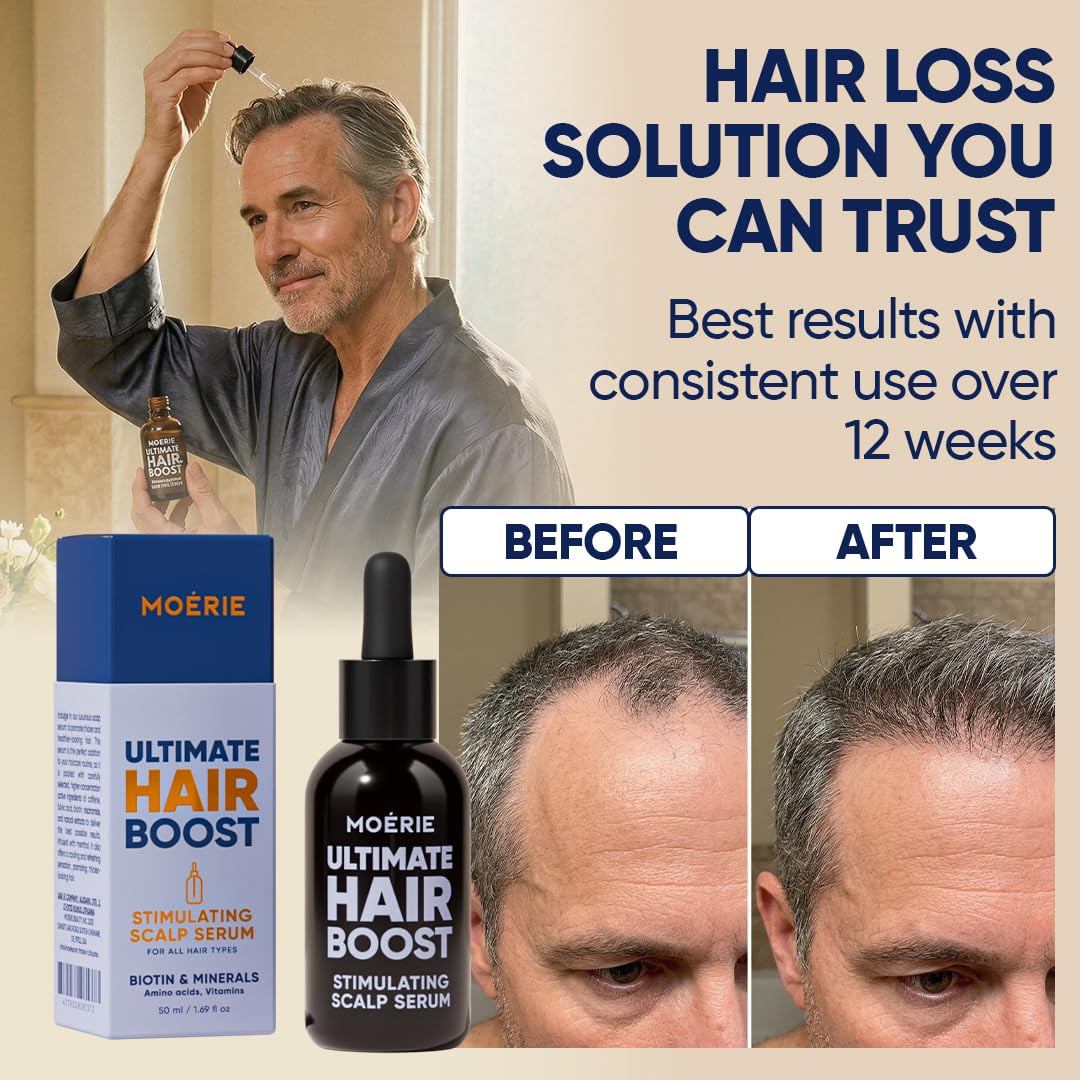 Ultimate Hair Growth Serum - Natural Hair Regrowth & Thickening Treatment for Women - 1.69 fl oz / 50 ml