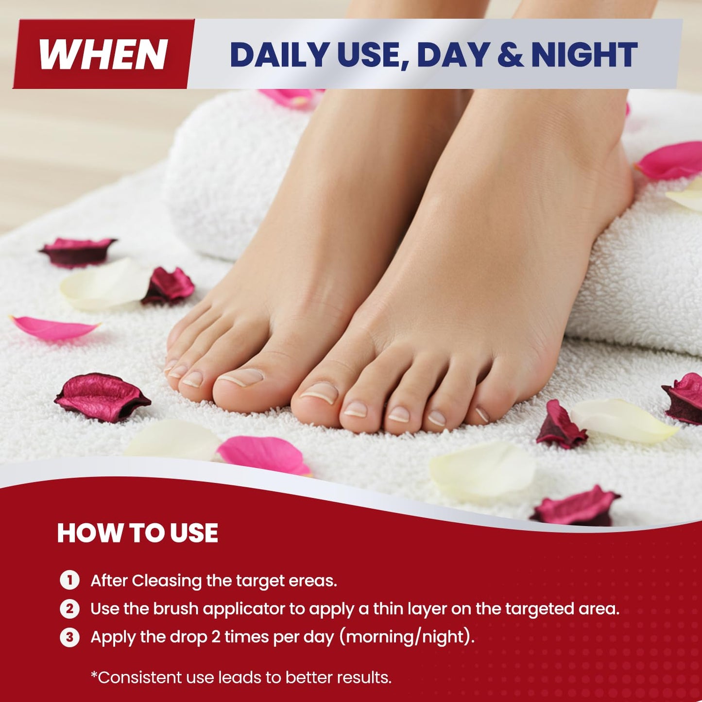 Treatonic Toenail Treatment Kit: Extra Strength - 45-EFWI-VBGG