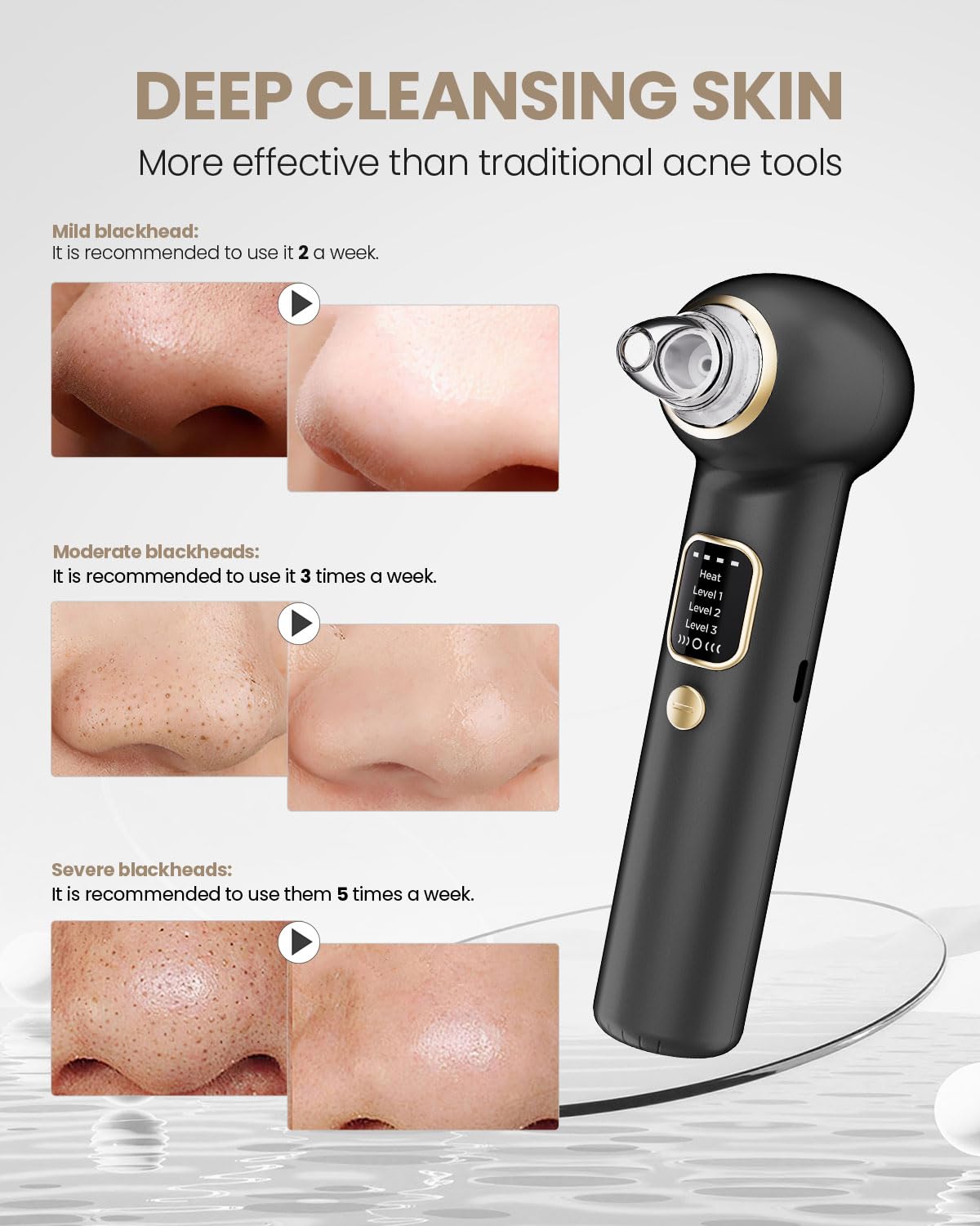 Blackhead Remover Pore Vacuum with Heating - Blackhead Extractor with 3 Adjustable Suction Levels, 5 Probes - Blackhead Remover Tools for Women & Men