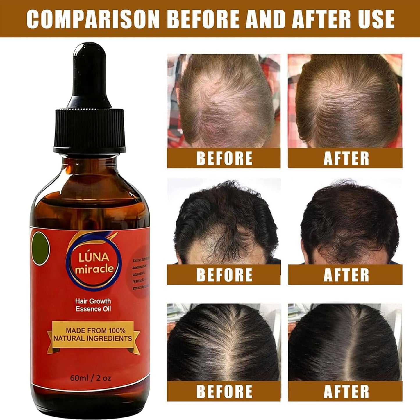 Luna Miracle Hair Growth Oil - 100% Natural Essence for Frizzy & Damaged Hair | 2 Ounce (2PCS)