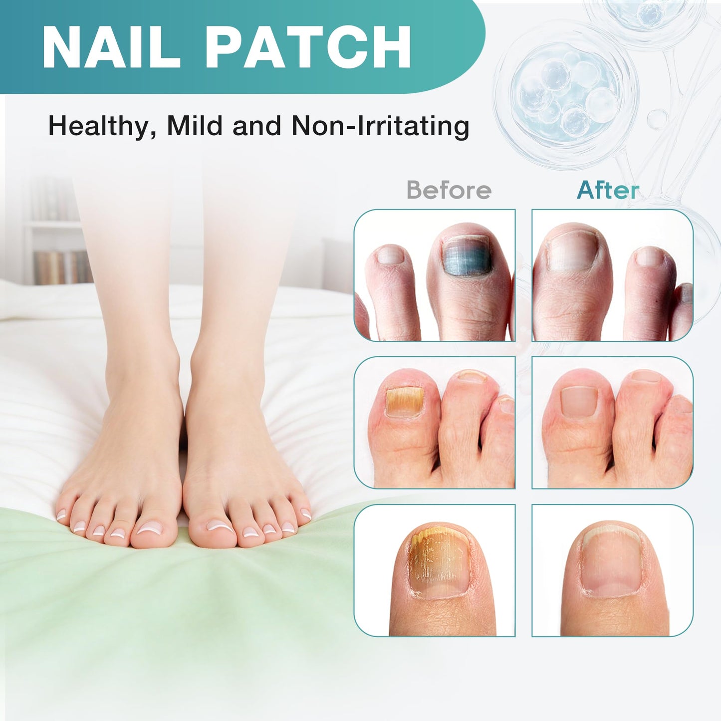 DR.RAPID Fungal Nail Patches, Toenail Fungus Treatment Extra Strength - 20 Fungal Nail Patches for Toe Nail Fungus Treatments, 8-Hour Nighttime Nail Fungus Patches for Nail Fungus Treatment