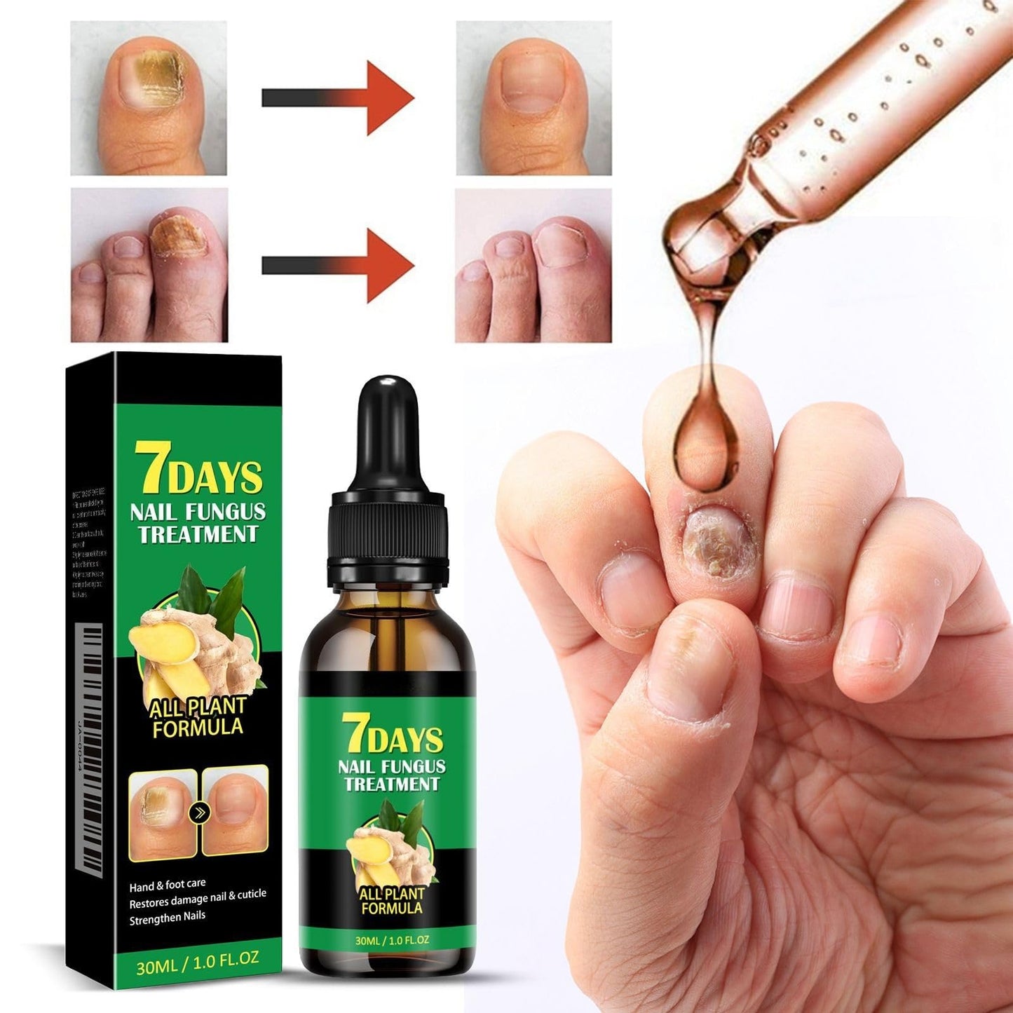 Ginger Nail Growth Serum, Nail Serum 7 Days Intense Repair for Nails Edges, 30ml