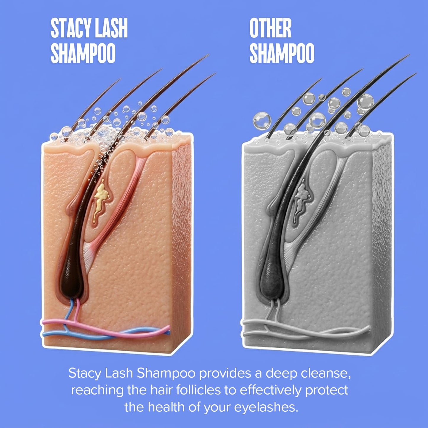 STACY LASH 6.76 fl.oz / 200ml Eyelash Extension Shampoo + Brush/Korean Makeup Remover/Eyelid Foaming Cleanser/Wash for Extensions & Natural Lashes/Supplies for Professional & Home Use