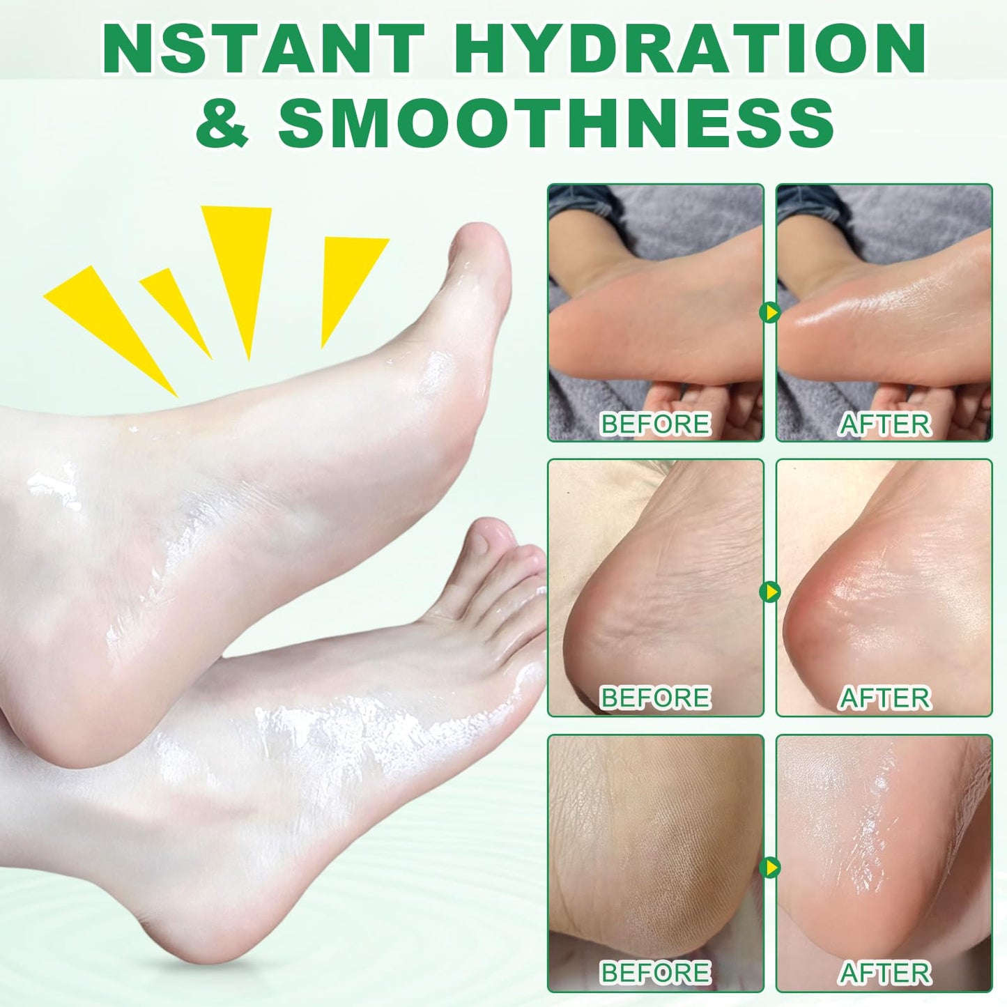 60% Urea Cream with 2% Salicylic Acid & Aloe vera Cracked Heel Stick, Long-lasting Moisture, Repair Cracked Heels, Deep Moisturizing Heel Balm with Aloe Vera, Coconut Oil, Tea Tree Oil, 1.41 oz / 2PCS
