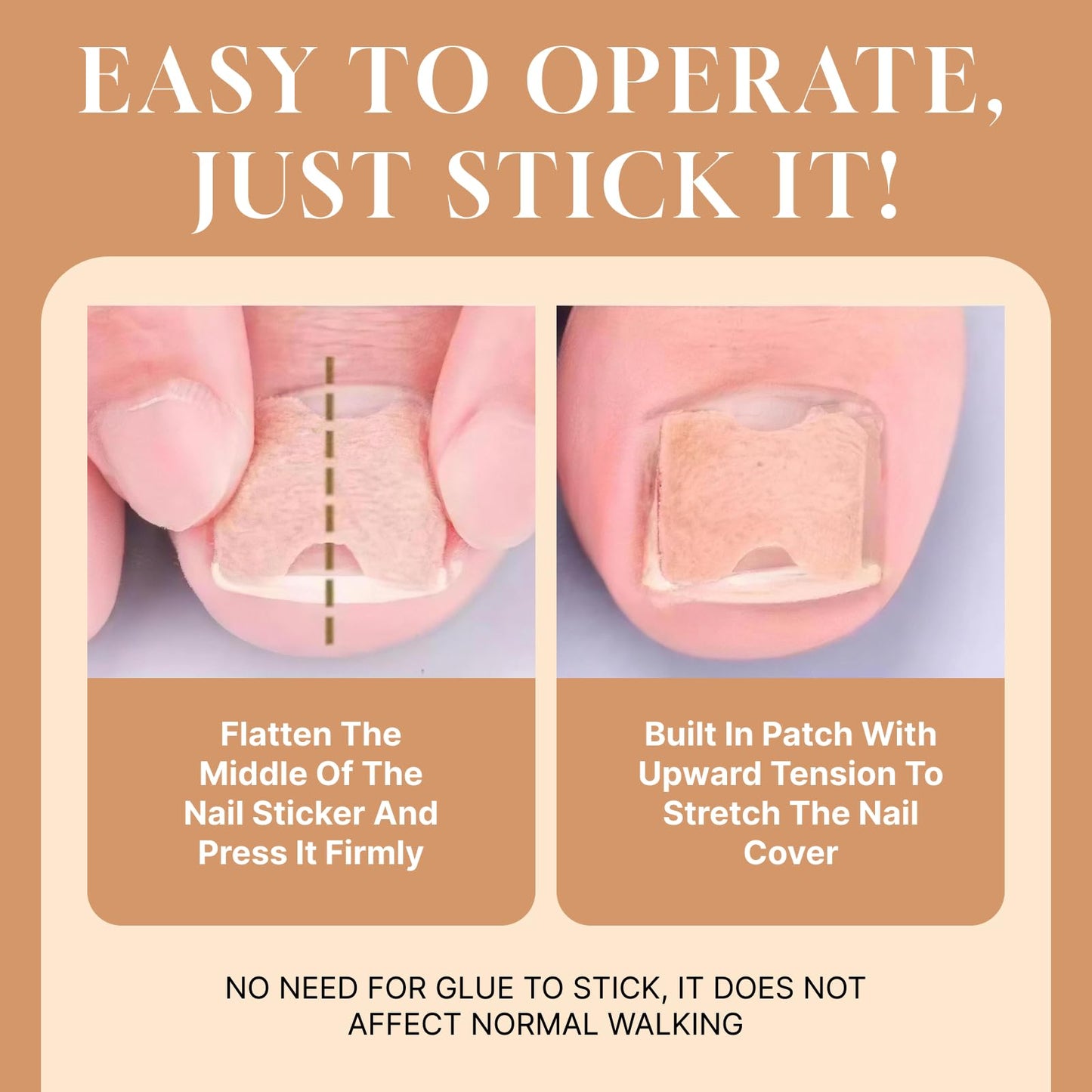 Ingrown Toenail Treatment Strips, 80Pcs Breathable Glue-Free Ingrown Toenail Corrector Patches with File, Professional Non-Slip Toenail Care Tools