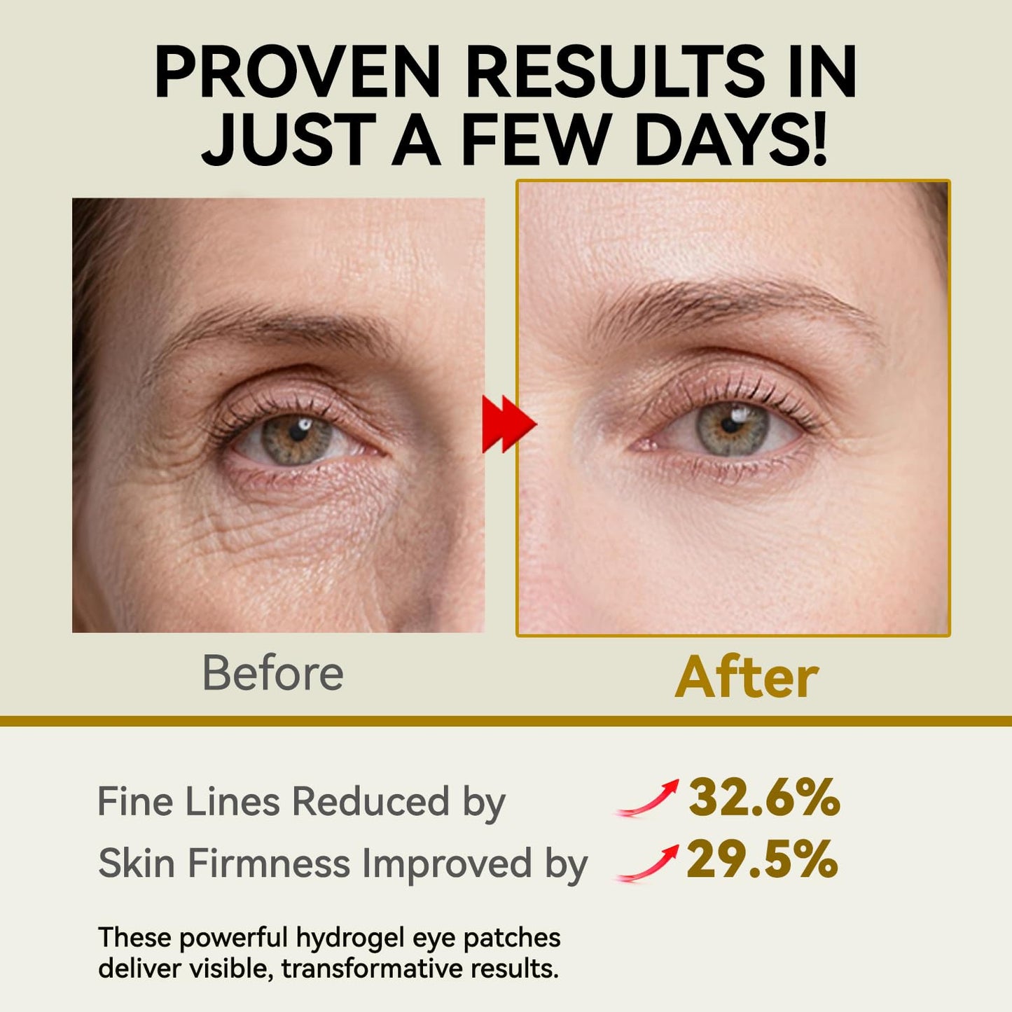 PDRN Under Eye Patches, 25 Pairs Retinol & Caffeine Eye Mask, Collagen Hydrating Eye Pads for Dark Circles, Puffy Eyes & Wrinkles – Eye Treatment Skincare Gift for Men & Women