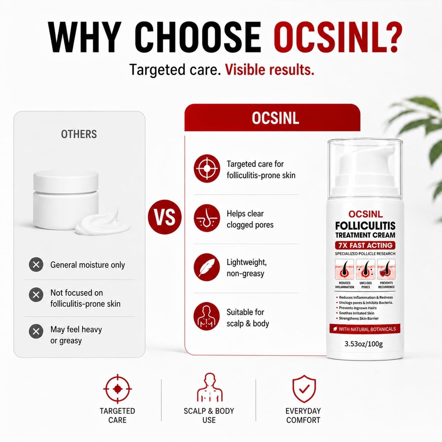 OCSINL Folliculitis Cream 5% Benzoyl Peroxide Scalp Body Care