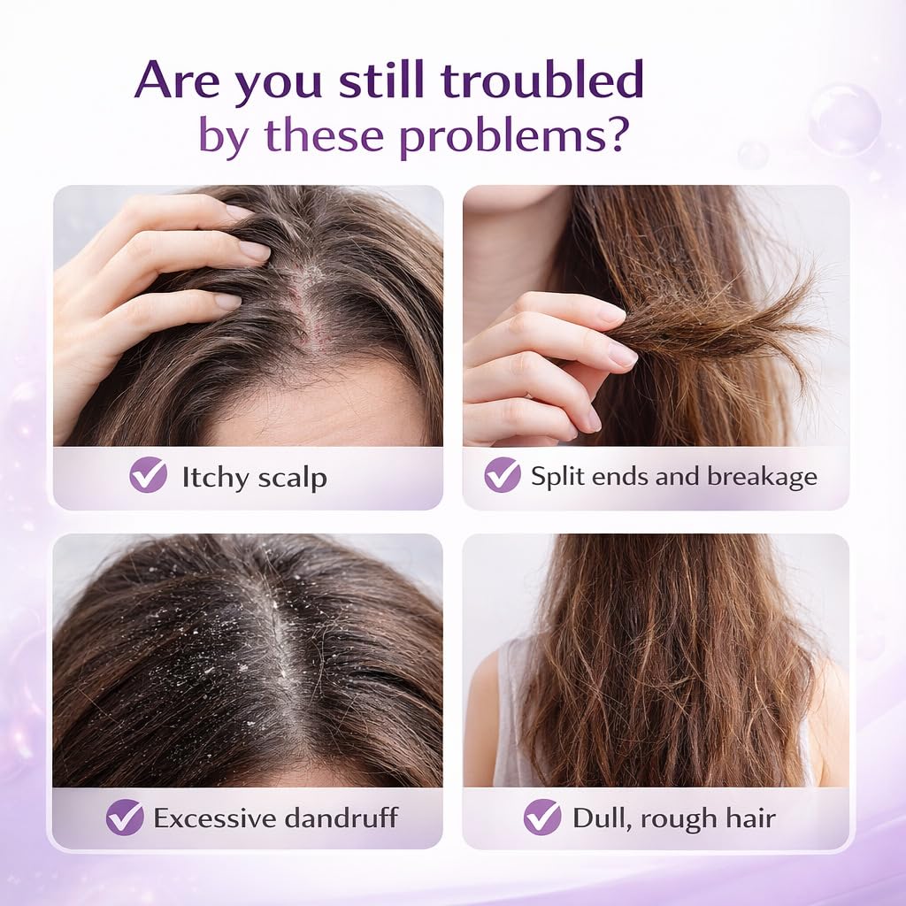 ekxzvg Onion Shampoo for Hair Growth, with Rosemary Oil & Red Onion & Cinnamon Extract, Effectively Reduce Hair Loss Promotes Thicker Fuller Hair 200ml (200ML/6.76OZ-2PCS)