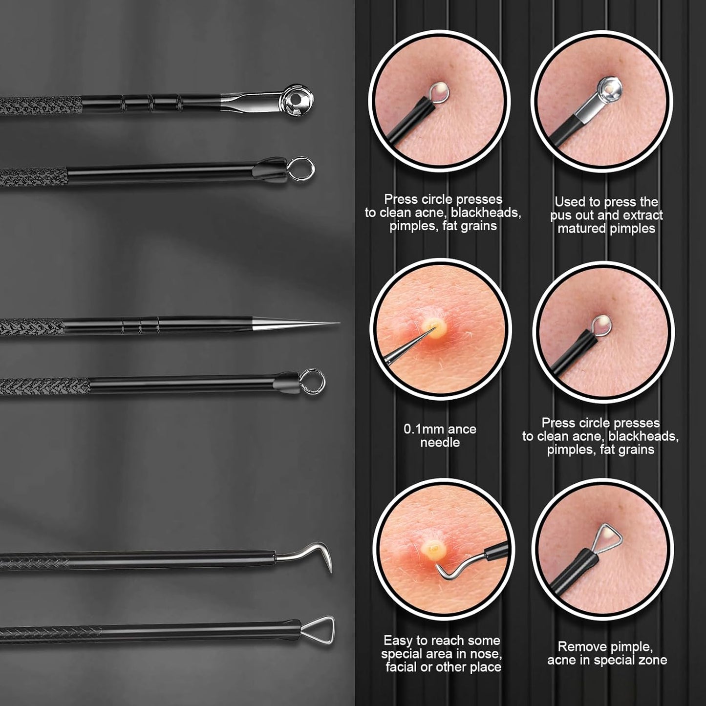 Blackhead Remover Tool Kit - 9 Pcs Stainless Steel Comedone Extractor for Acne, Pimples & Whiteheads | Facial Care Tools