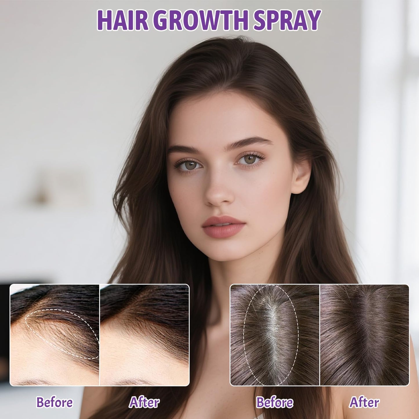 5% Minoxidil Spray with Biotin - Regrowth Treatment for Men Women, Promotes Thicker, Stronger, Fuller Hair, Prevents Hair Loss, for Men Hair & Beard, for Women Hair Growth, 3.38 oz (Purple)