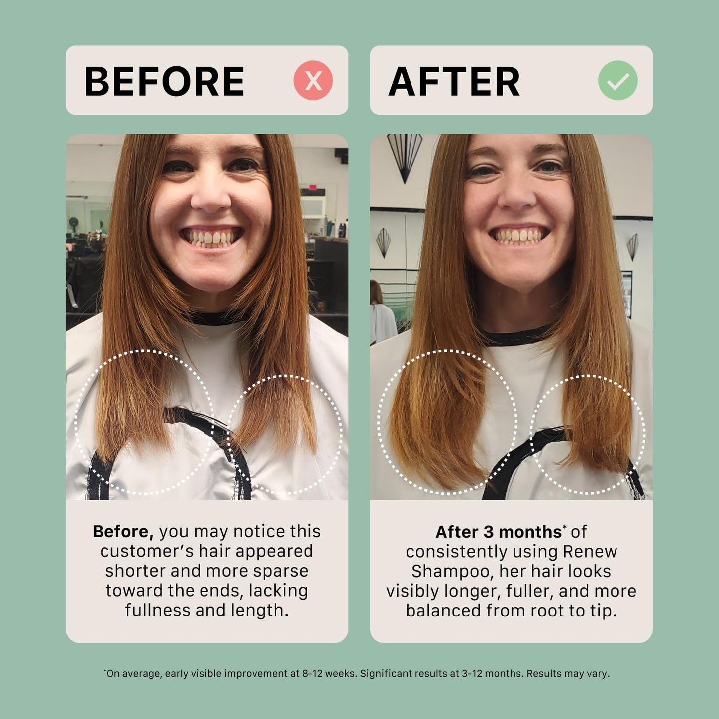 ACTIIV Renew Travel Duo | Scalp Health & Fuller Hair Support, Hydrating Plant-Based Formula - Unisex