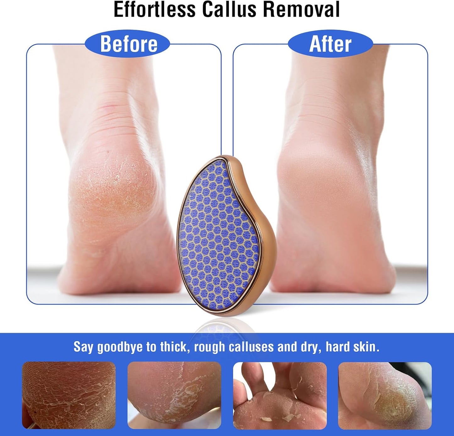 Glass Foot File Callus Remover - Nano Glass Heel Scraper for Smooth Feet | Pedicure Tool for Dead Skin Removal