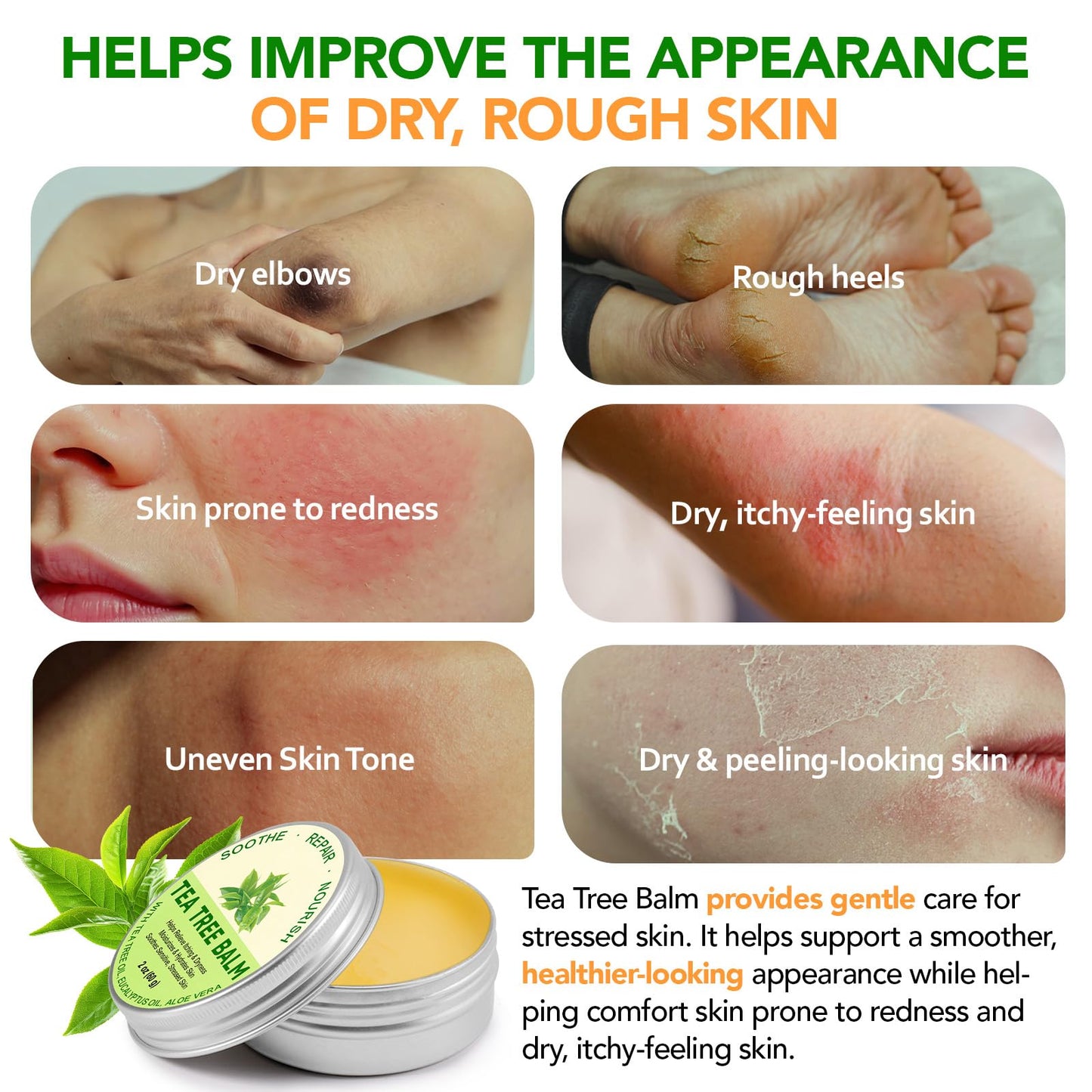 ABOUME Tea Tree Oil Balm, Tea Tree Balm Help Dry, Itchy & Fungal-Prone Skin, Soothing Moisturizing Balm Suitable for Feet, Heels, Hands & Body, Natural Formula, 60g (1PCS)