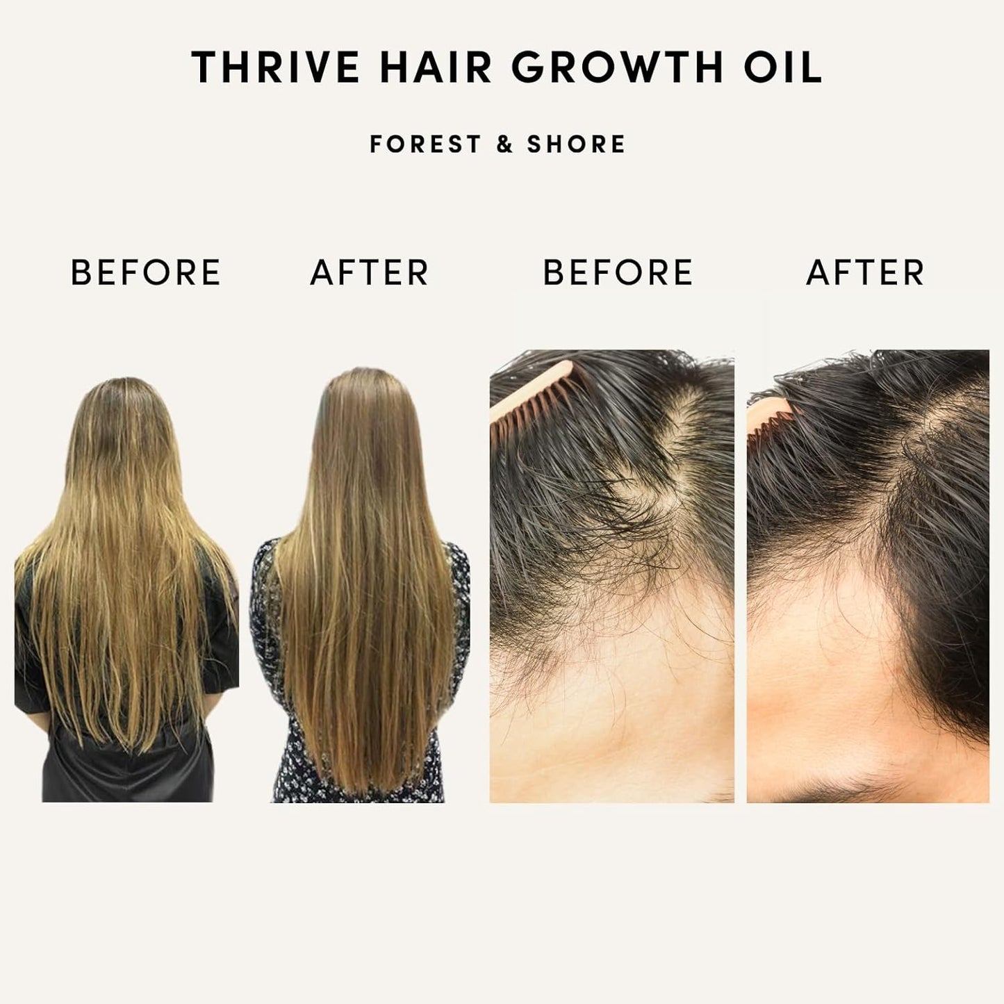 Hair Growth Oil - 100% Natural Caffeine & Biotin Serum for Damaged Hair | Argan & Rosemary Infusion