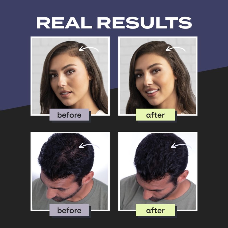 Toppik Hair Building Fibers, White, 55g Fill In Fine or Thinning Hair, Instantly Thicker, Fuller Looking, 9 Shades for Men & Women, Keratin Protein Formula