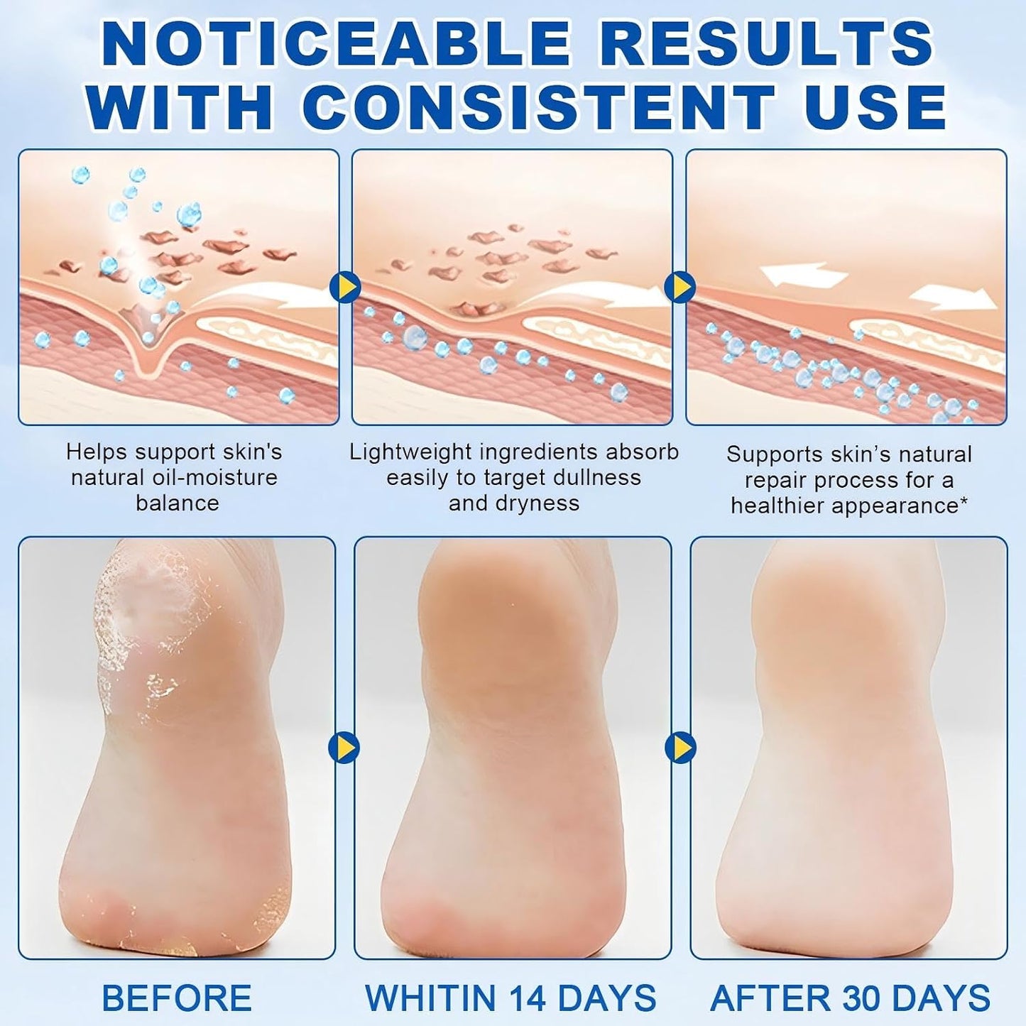 Urea Foot Cream Stick - 60% Urea & 2% Salicylic Acid for Deep Moisturizing | Gentle Exfoliation & Callus Remover