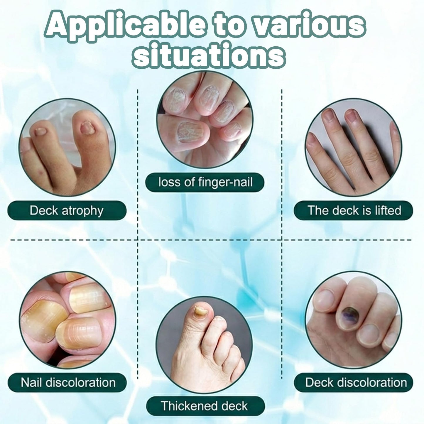Wellanail Treatment, All Natural WellaNail Premium Support for Overall Health, Make Nails Look Healthier Stronger (Brown)