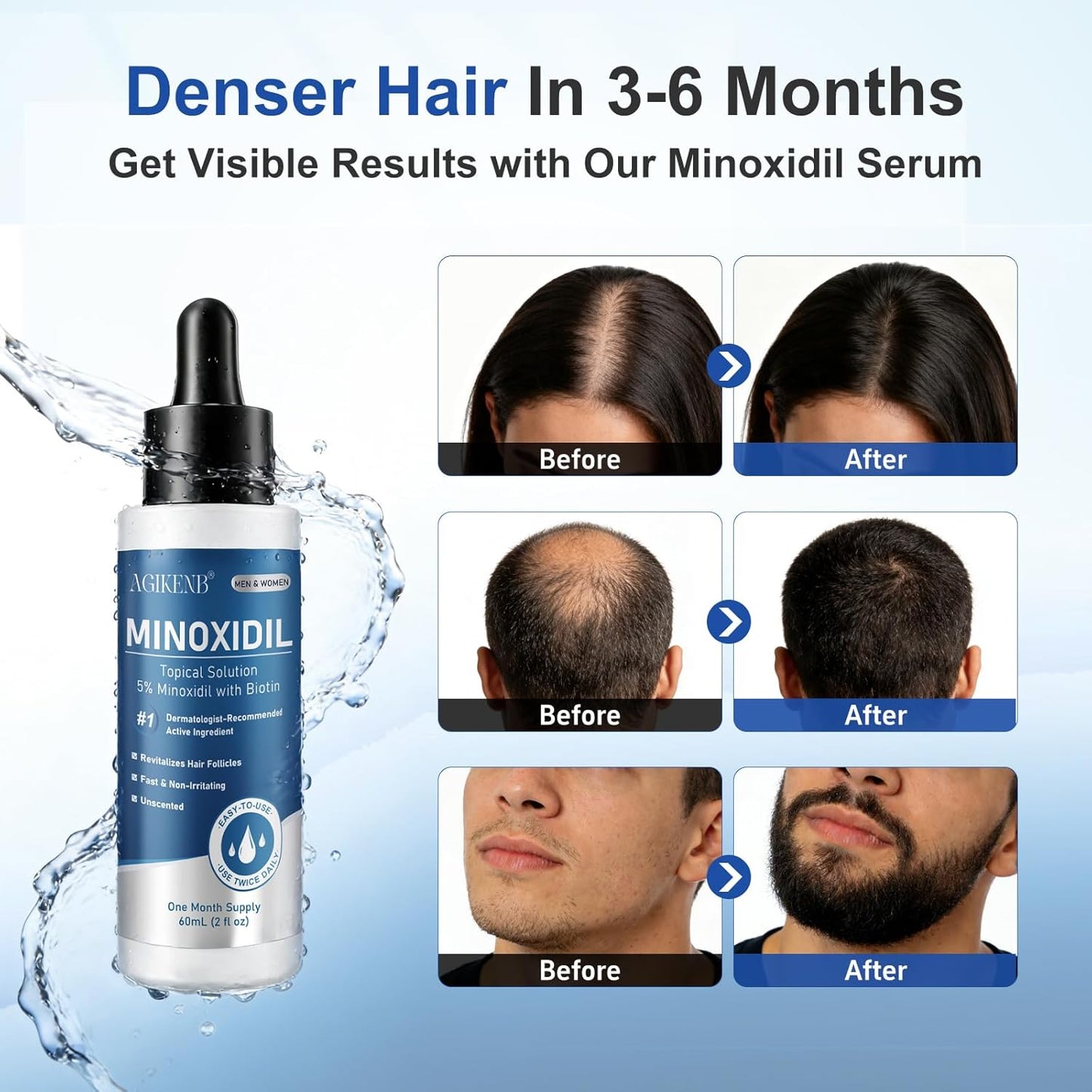 5% Minoxidil Hair Regrowth Serum - Biotin-Enriched Solution for Thicker Hair & Beard | 8 Pack, Extra Strength, 8 Month Supply