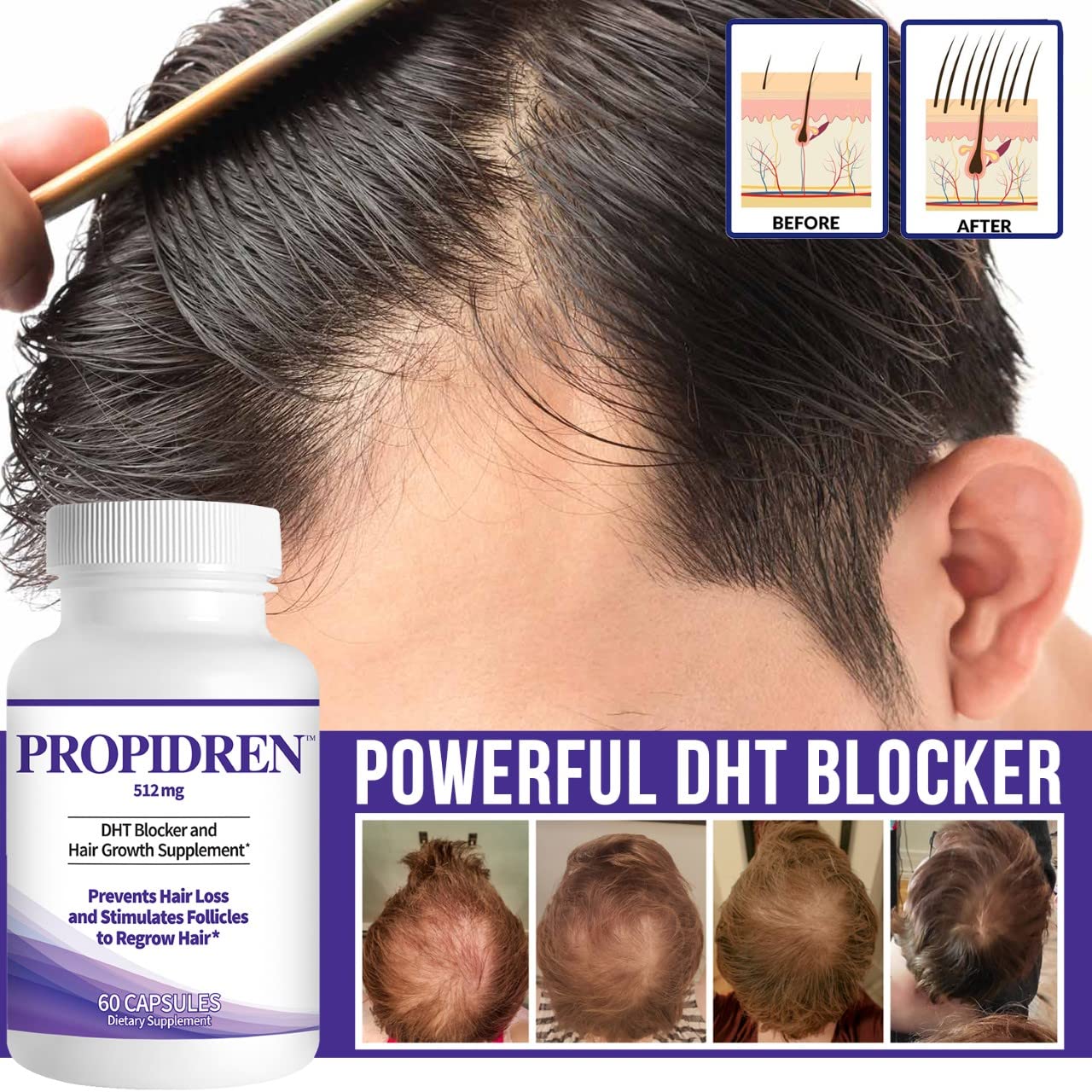 Propidren DHT Blocker & Hair Growth Pills To Stop Hair Loss and Regrow Hair