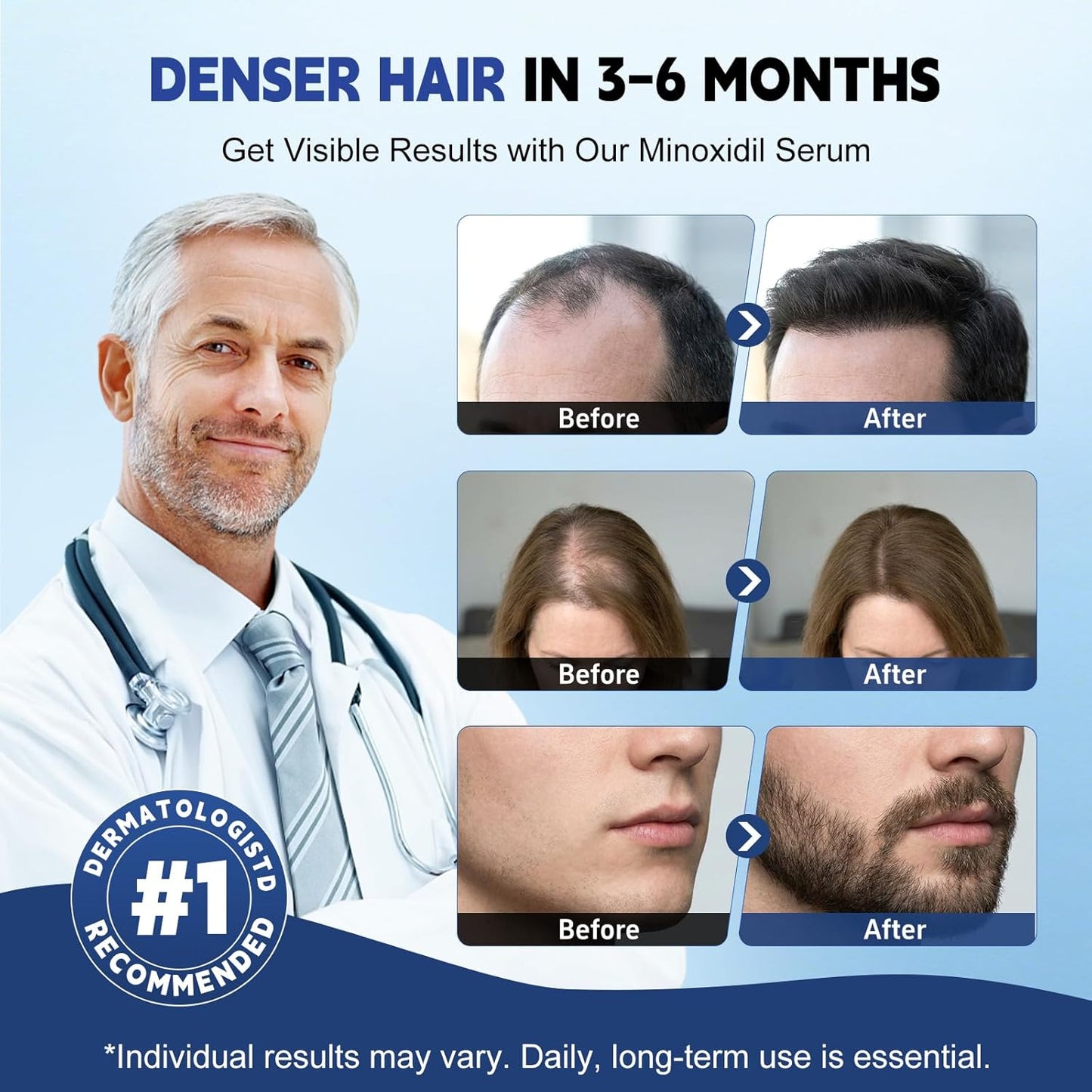 5% Minoxidil Hair Growth Treatment - Extra Strength Liquid Solution for Thicker, Fuller Hair | 8 Pack, Biotin & Castor Oil Enriched
