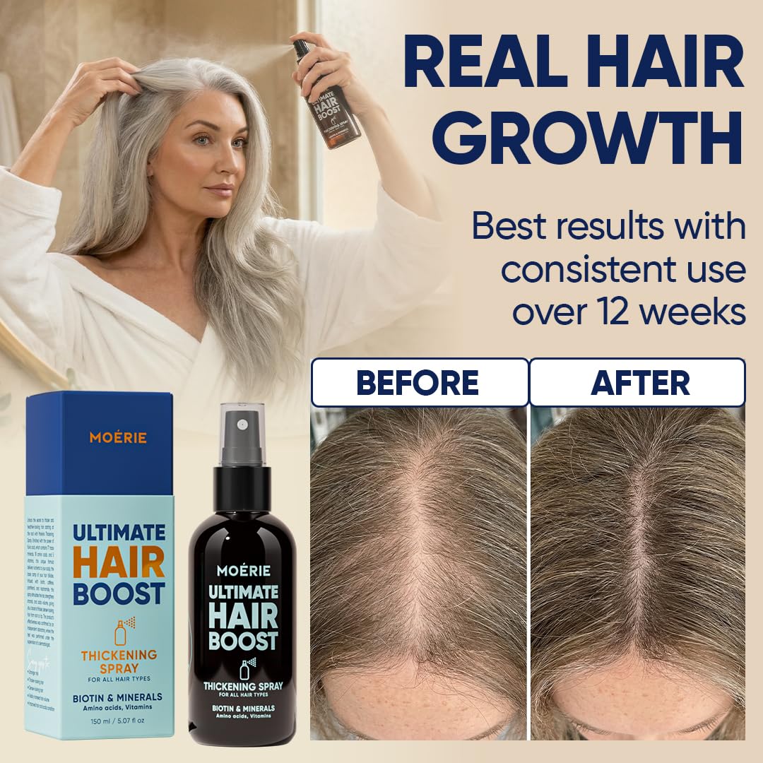 Moerie Hair Growth Serum Spray - Biotin & Rosemary Formula for Thinning Hair | Scalp Care & Regrowth Solution