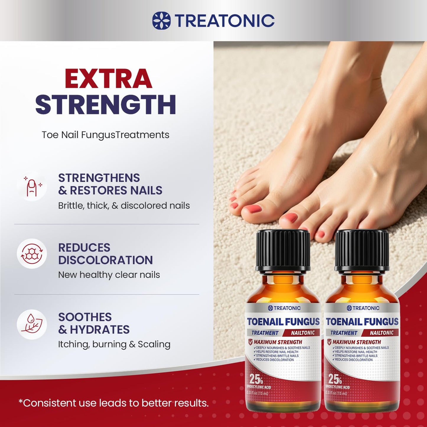 Treatonic Toenail Treatment Kit: Extra Strength - 45-EFWI-VBGG