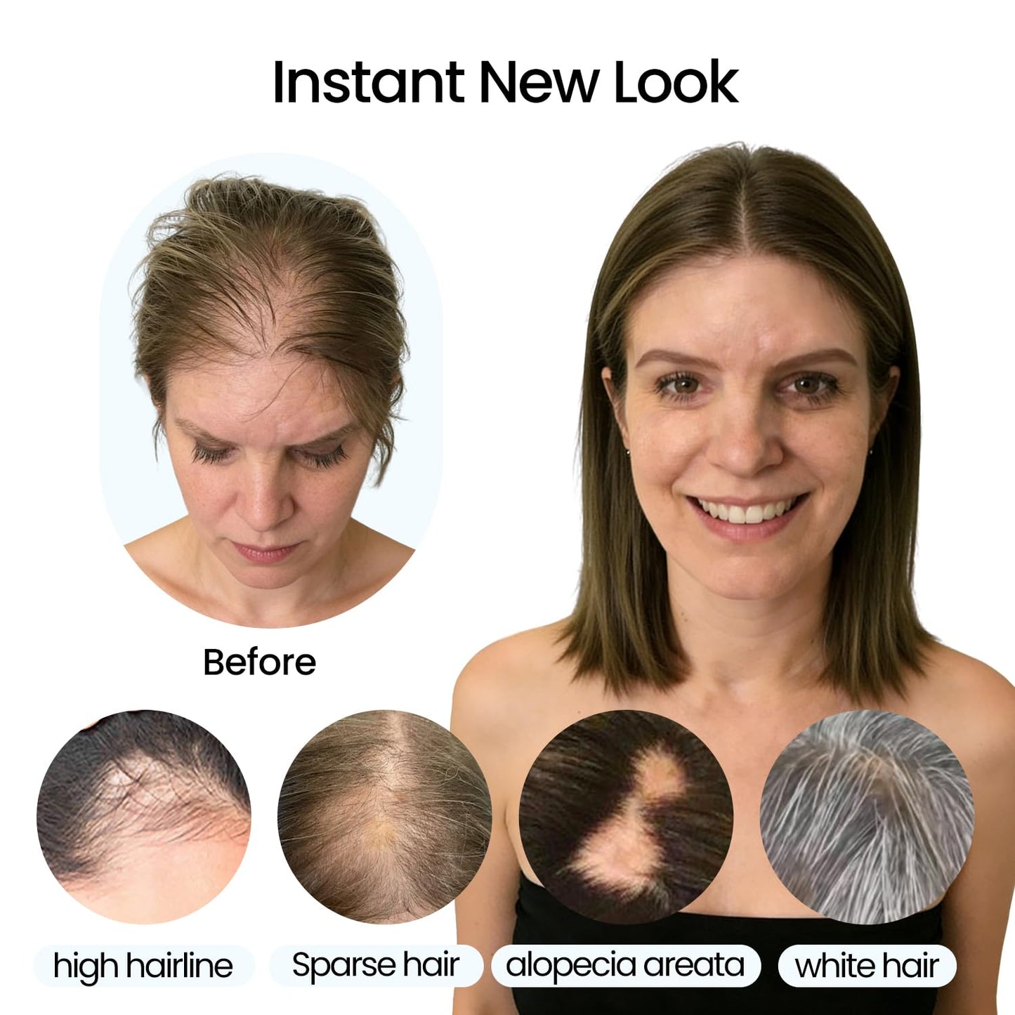 Real Human Hair Toppers for Women - Thinning Crown Solution | 6x7 Inch, 150 Density, 14 Inch Platinum Blonde