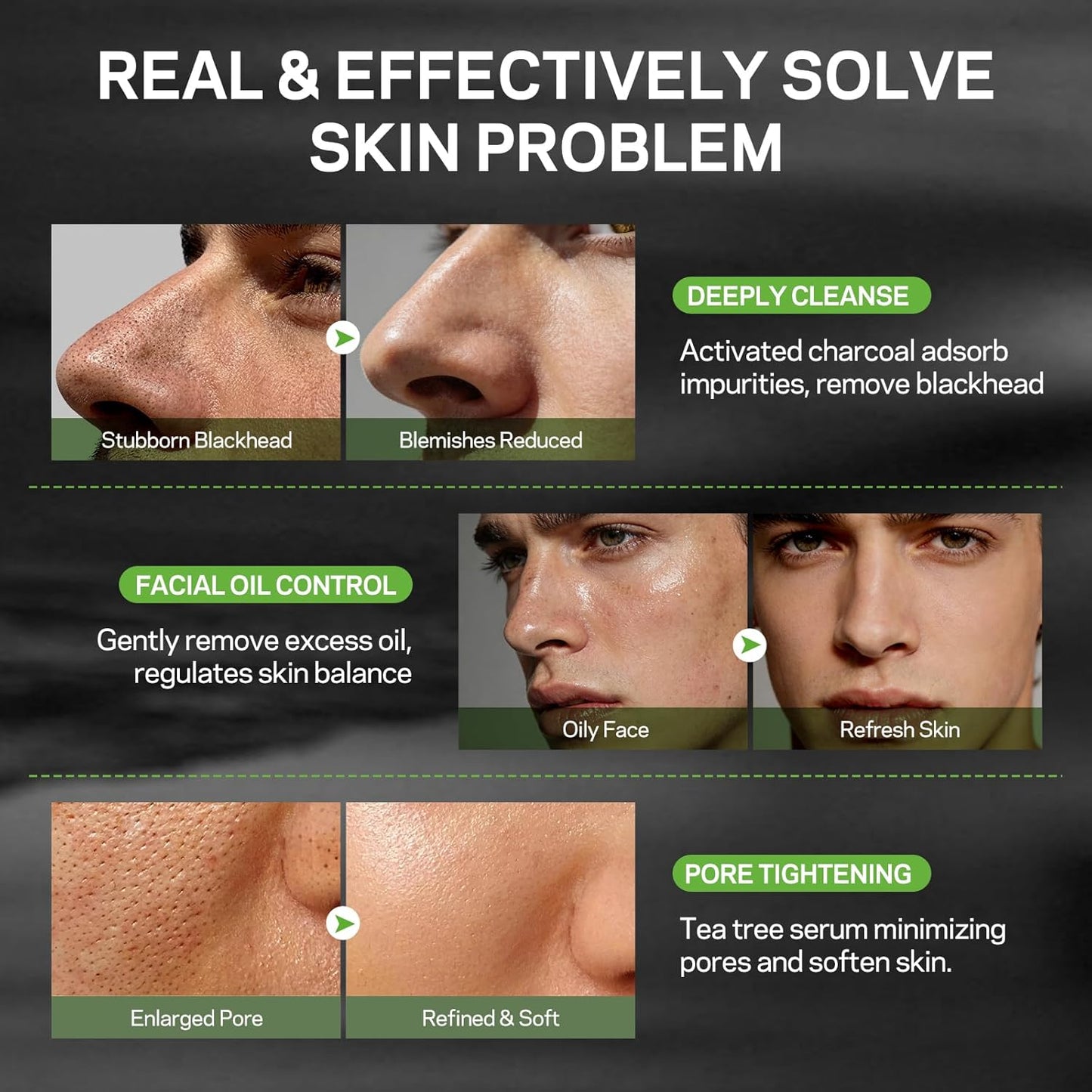 Blackhead Remover Peel Off Face Mask Set - Charcoal & Tea Tree Oil Duo for Deep Cleansing | 2-in-1 Pore Tightening Solution