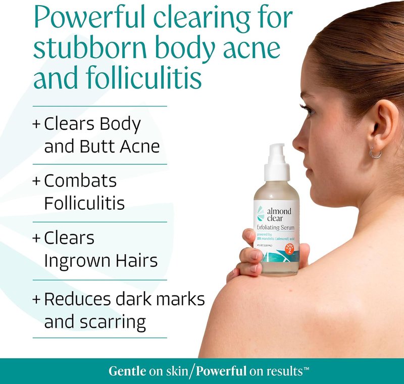 Body Clearing Serum - Level 2 Acne Treatment with Mandelic Acid | 1 Fl Oz for Body, Back, Chest & More