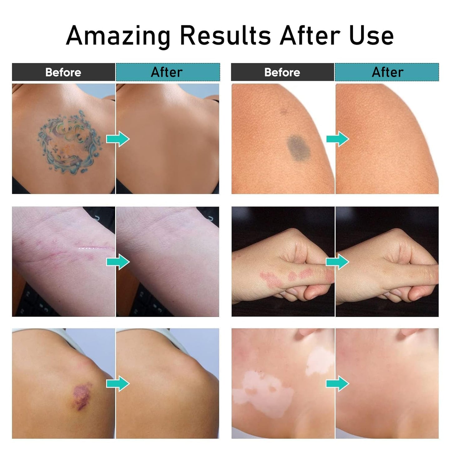 Tattoo Cover Up Makeup - Waterproof Leg & Body Concealer | Ivory White, No Transfer Formula