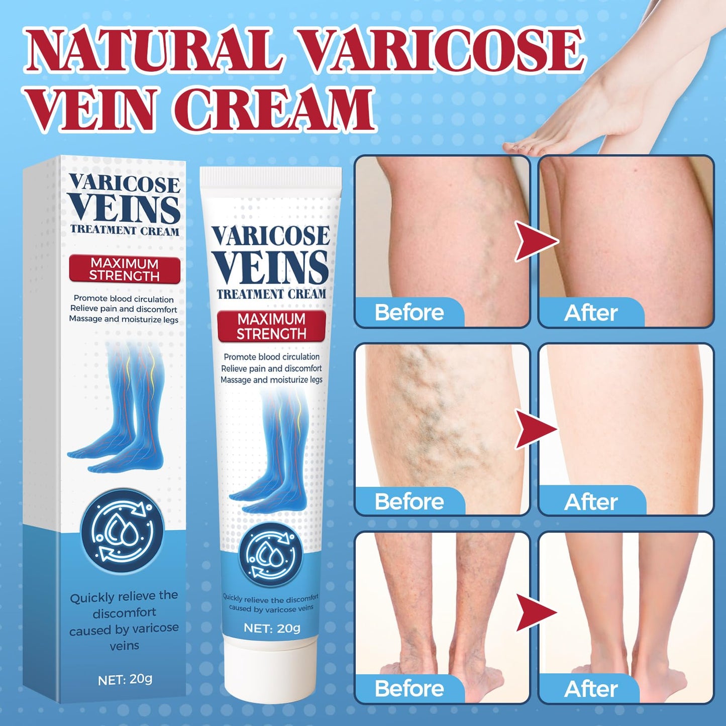 Bellisinno Varicose Veins Treatment for Legs, Varicose Veins Cream for Spider Veins, Relaxing Leg Cream Formula to Improve Circulation, Soothe Tired Legs and Reduce Heaviness