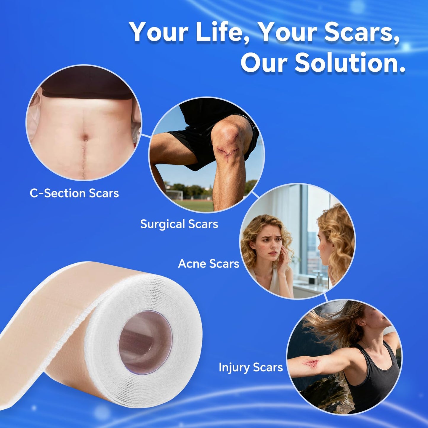 Silicone Scar Sheets - Professional Reusable Scar Tape & Patch for Effective Scar Treatment | 1.5M Length