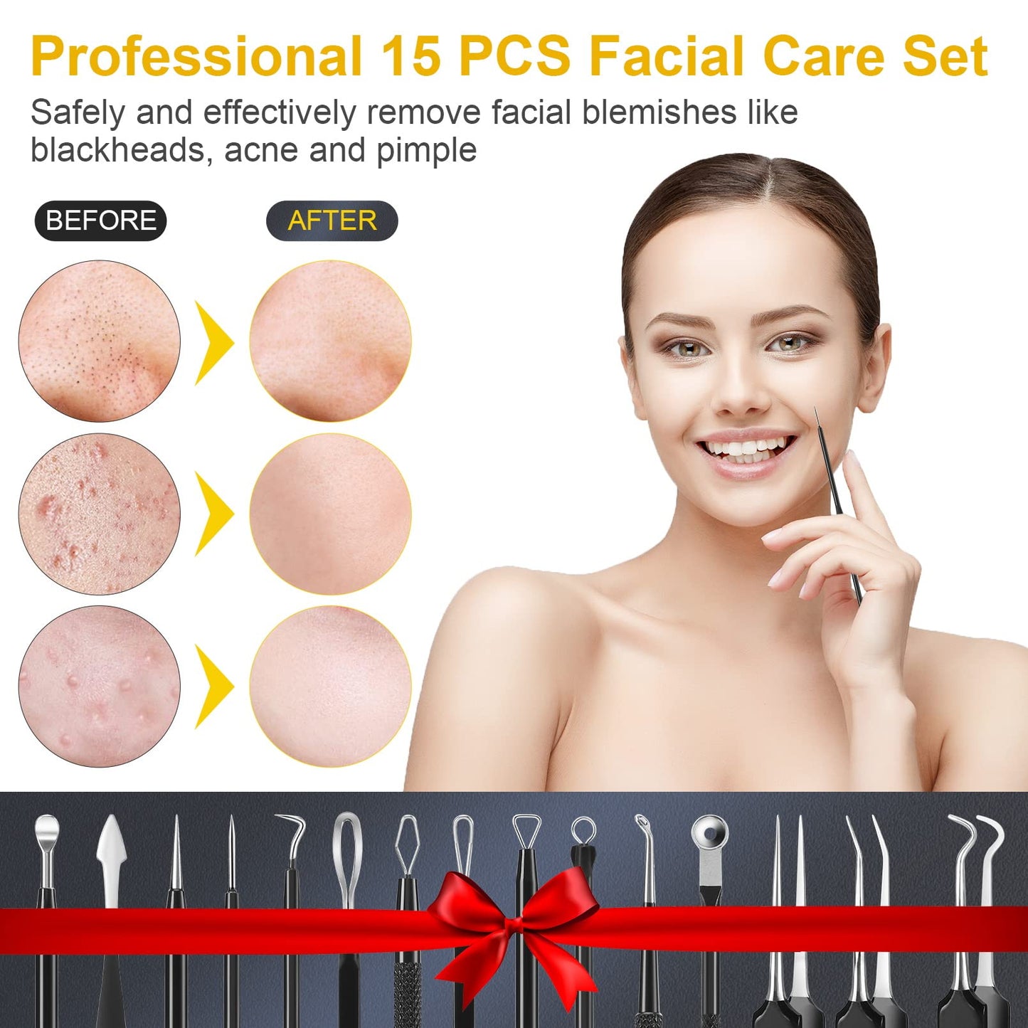 Pimple Popper Tool Kit, IUMAKEVP 15 PCS Professional Stainless Steel Blackhead Remover Comedone Extractor Tools for Removing Pimples, Blackheads, Zit on Face - Acne Removal Kit with Metal Case (Black)